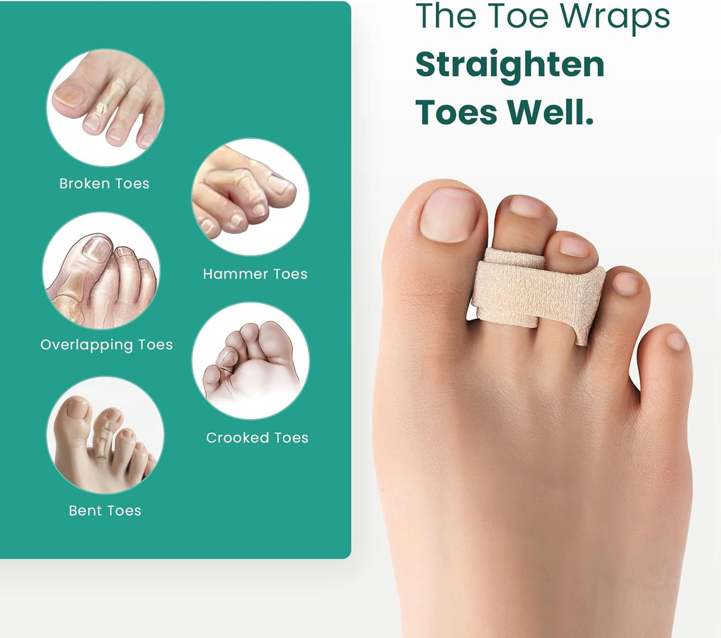 Welnove Hammer Toe Straightener - 8 Pack Broken Toe Wraps - Hammer Toe Corrector for Women - Toe Splints for Crooked Toes, Curled Toes, Bent Toes - (Multi-Size, Beige)