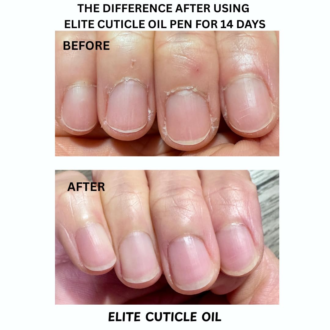 Elite Cuticle Oil Pen (Peach) – Hydrating Nail & Cuticle Oil with Jojoba Oil & Vitamin E – Sweet Scented Nail Care Treatment (3ML)