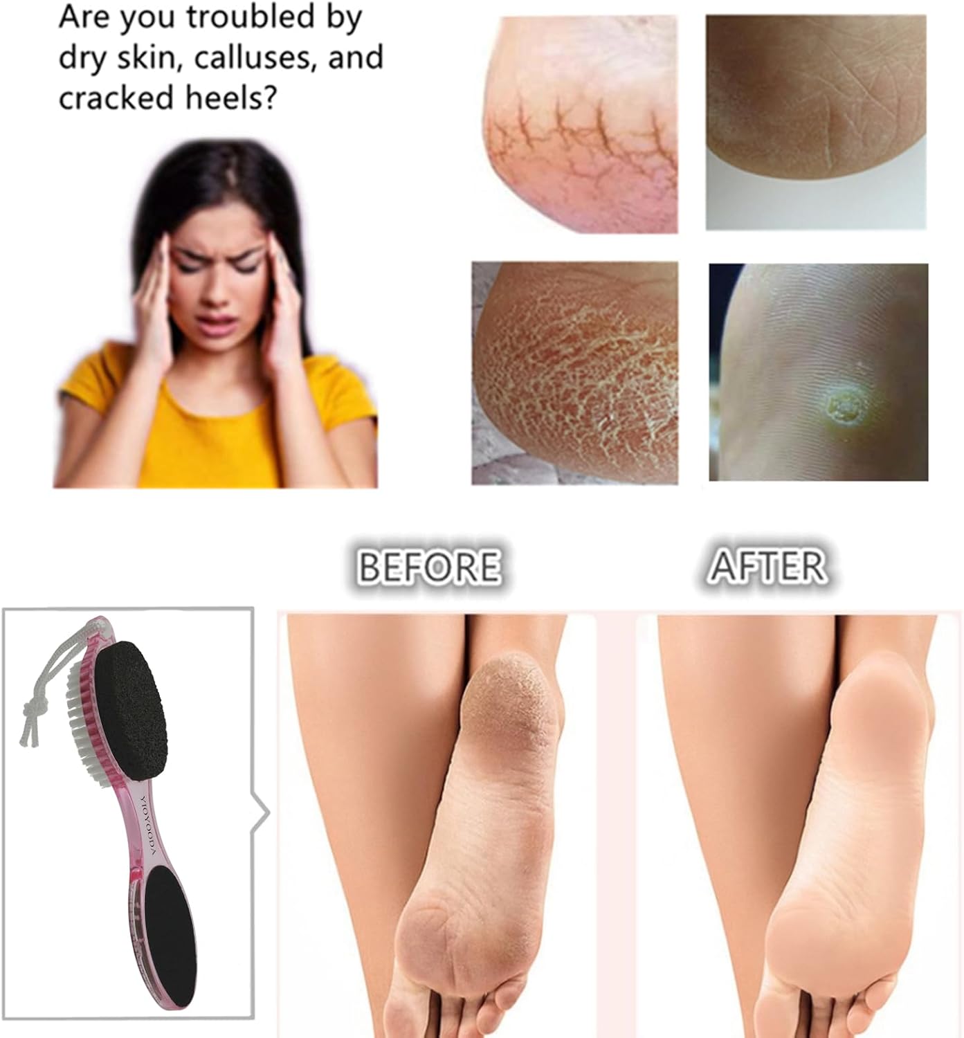 Foot File Callus Remover 4-in-1, Feet Scraper Pedicure Tools with Pumice Stone, Foot Scrubber Brush, Foot Rasp and Sand Paper, Double Sided Multi Purpose for Home Foot Care, Clear Pink