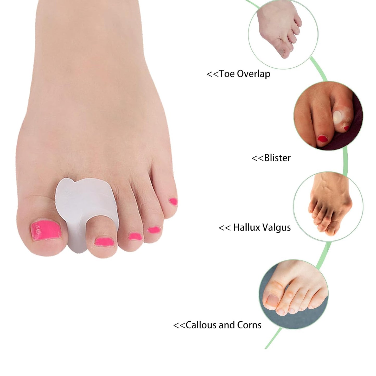 12pcs Gel Toe Spacers, Toe Separators to Correct Your Toes, Toe Support Big Toe Spacers for Overlapping Toes Bunions Hammer Toe Relaxation Restore Toes to Their Original Shape