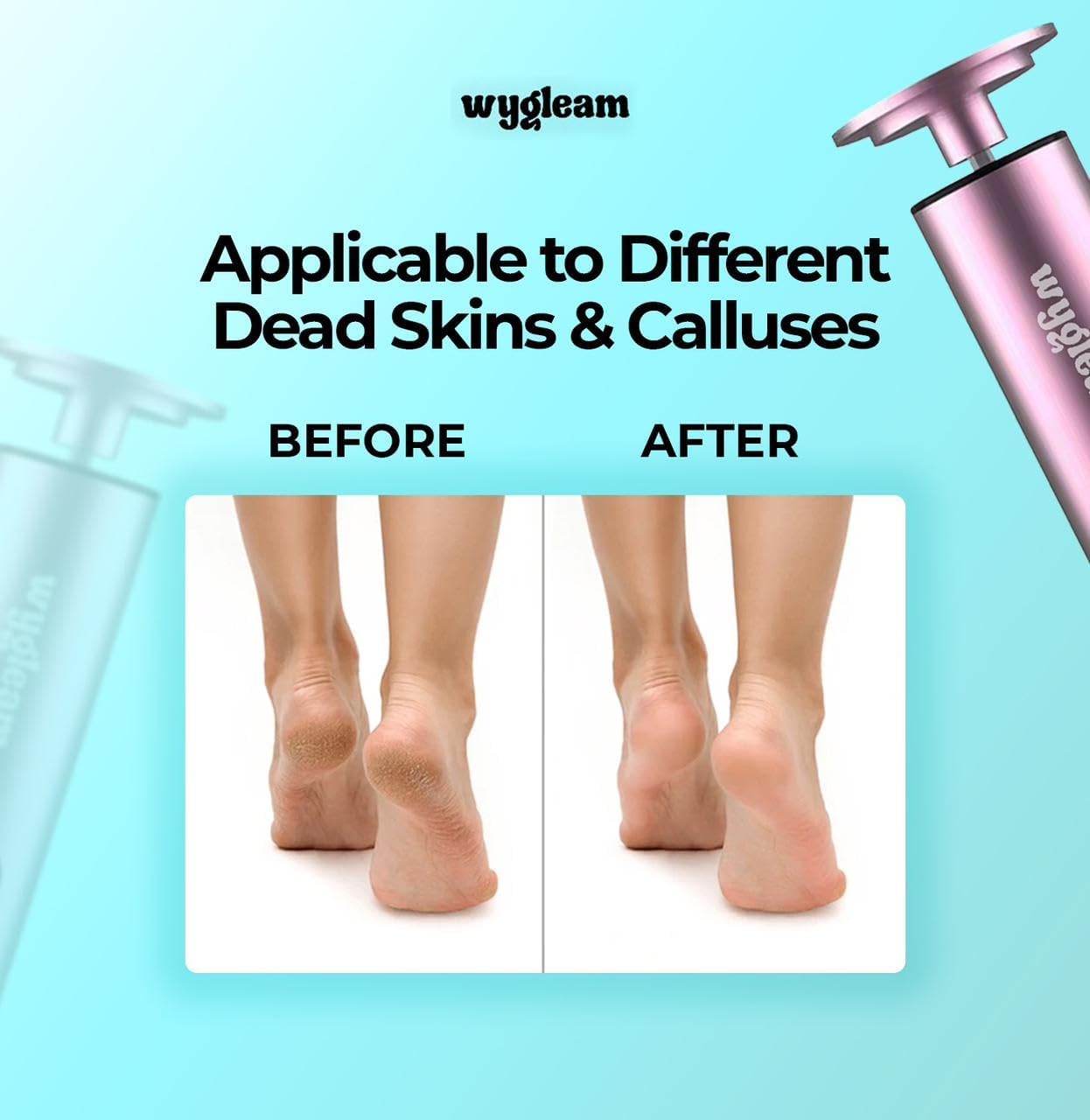 2-in-1 Electric Callus Remover and Nail File Drill Kit for Flawless Feet & Nails - 3 Speeds, Rechargeable, Professional at-Home Pedicure & Manicure Tool