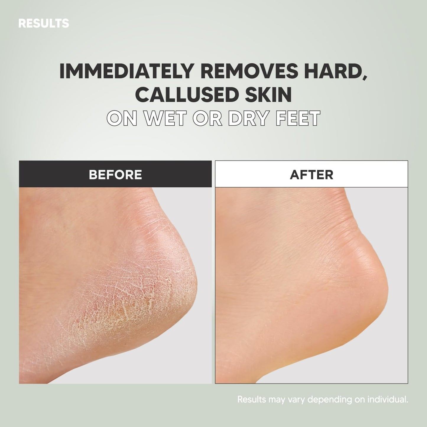 S-Line Emery Foot File, Colossal Double-Sided Pedicure Tool, Effective for Cracked Heel, Ergonomic Design for Easy Grip (2Pcs)
