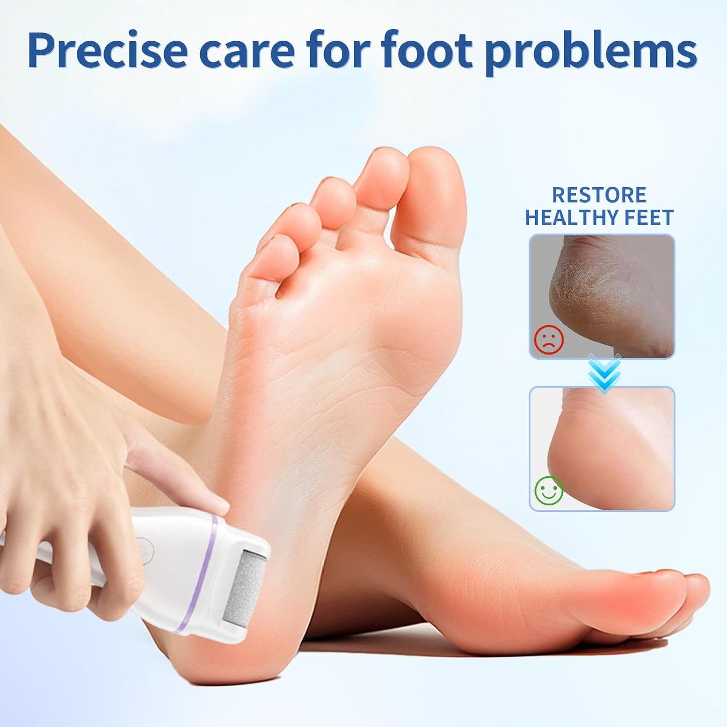 Rendoo Rechargeable Callus Remover for Feet - Cordless Foot Sander & Callus Grinder for Dry Cracked Heels, Electric Foot File with 3 Roller Heads for Smooth Feet, Battery Operated