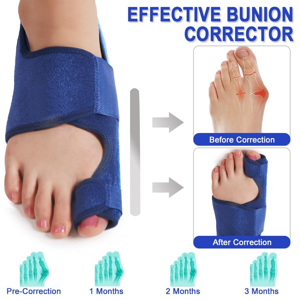 Toe Corrector Toe Separator Bunion Splint 【Updated Version】 Hallux Valgus Big Toes Corrector Set Bunion Brace Bunion Exercise Strap Orthopedic Kit Pain Relief (Blue, free)