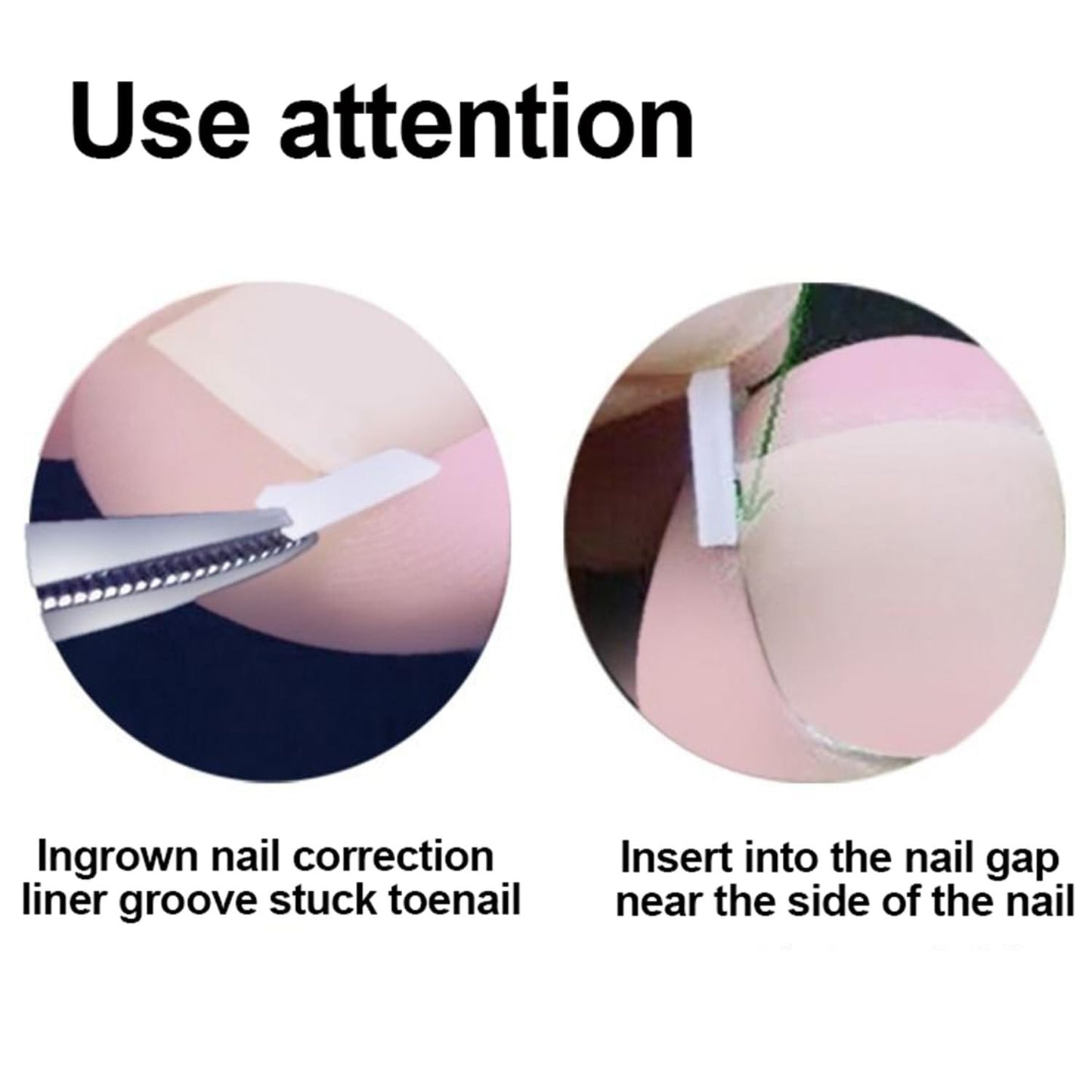 Professional Ingrown Toenail Toolkit with Breathable Ingrown Toenail Strips, Curved Toenails Corrector Patch, Painless File and Lifter for Home Pedicure Care
