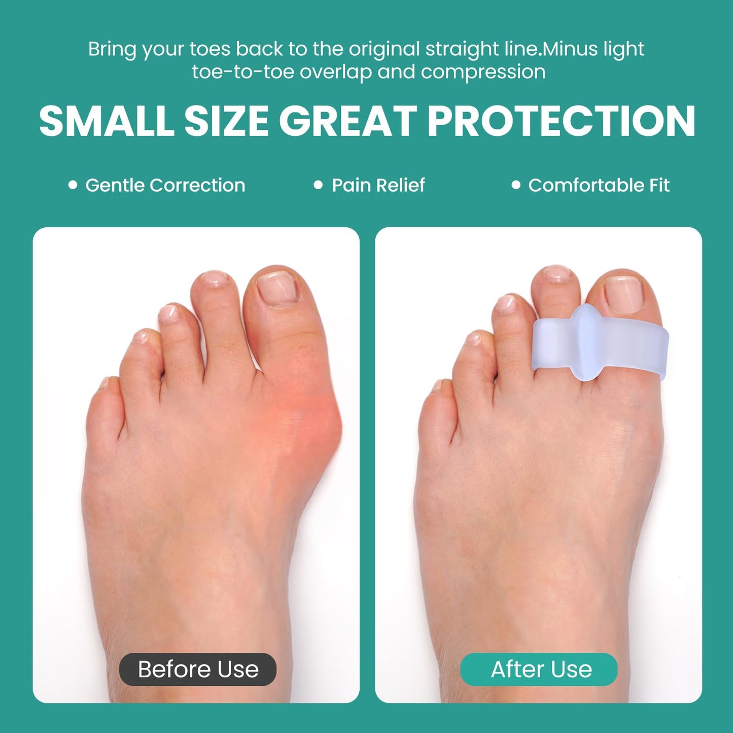 Welnove Pack of 12 Bunion Corrector, Toe Separators with 2 Loops, Big Toe Spacer Suitable for Bunion and Overlapping Toe (Violet)