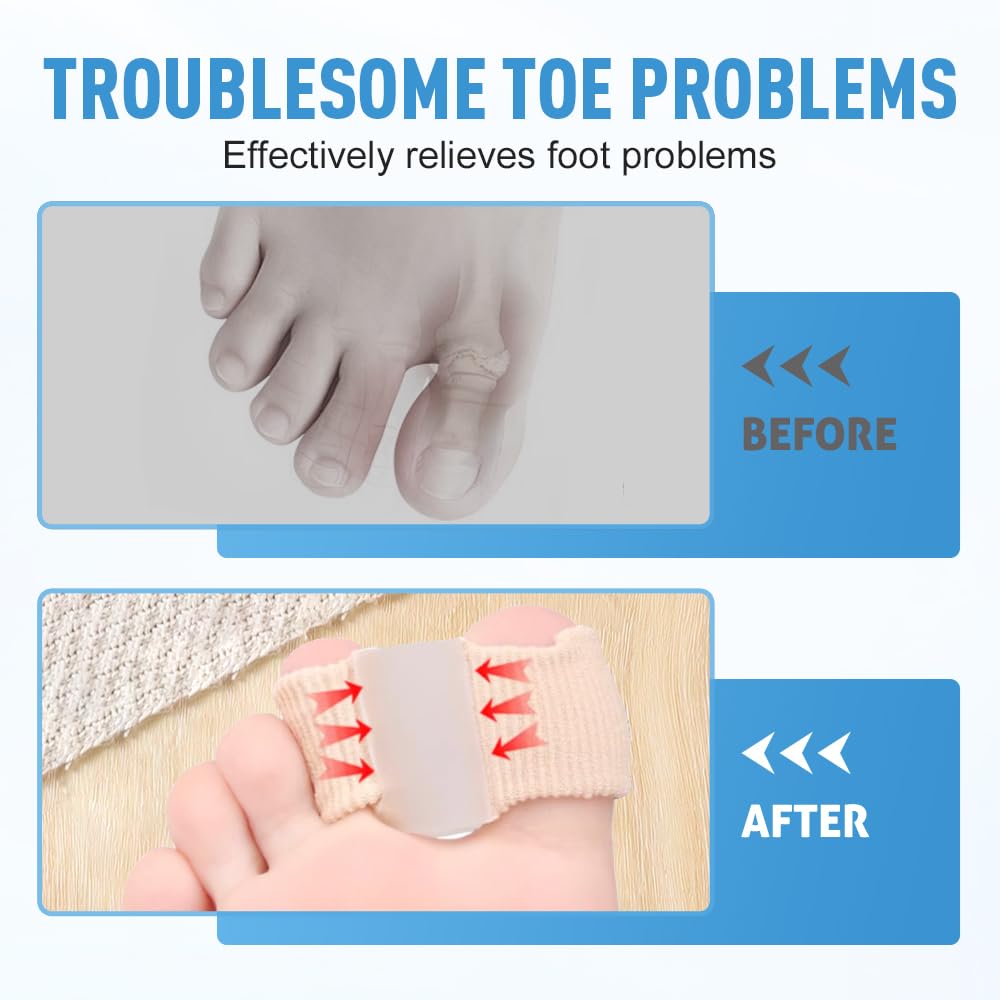 Toe Separators for Overlapping Toes, 2025 New Multifunctional Gel Toe Spacers Corrector with 2 Loops, PremiumToe Straightener for Women and Men Foot Care Tool (12 Pcs, S)