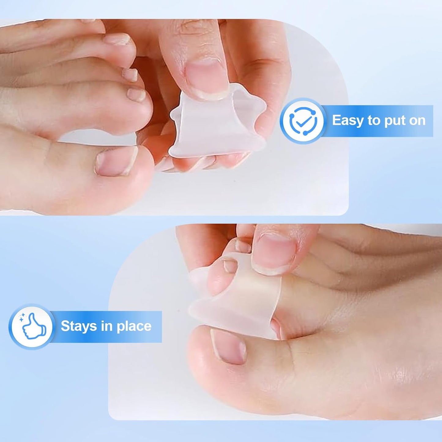 Hammer Toe Corrector, 6 Pack Toe Spacers, Toe Straighteners for Curled Toes, Bunion Corrector for Preventing Rubbing & Relieve Pressure (Small)