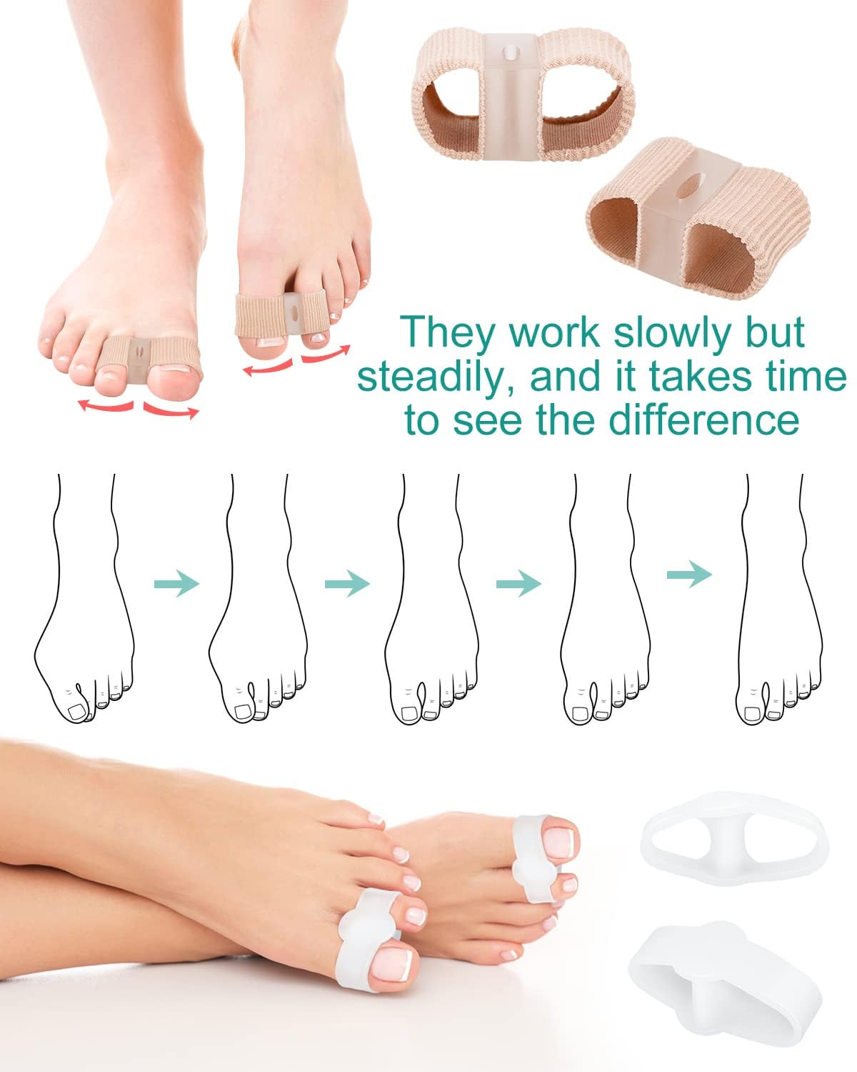 12Pcs Toe Separators Bunion Corrector for Women Men, Gel Big Toe Spacers with 2 Loops for Feet, Hammer Toe Straightener, Elasticity and Soft (6Nylon+6Gel)