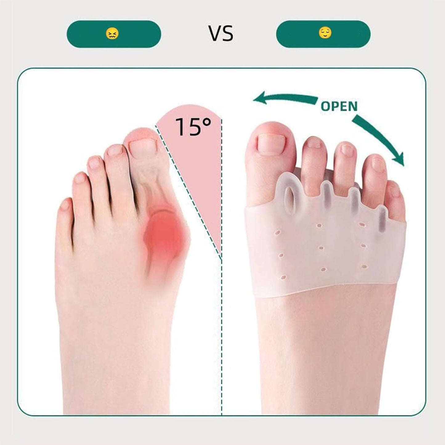 Silicone Toe Separators- Toe Separator for Women, Hallux Valgus Relief - Toe Straightener & Spacer for Women & Men (Multicolored-4PCS)