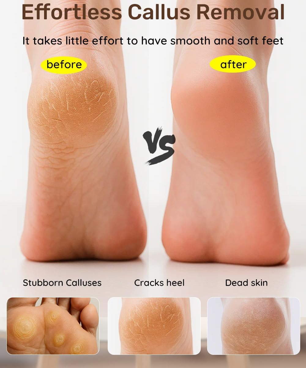 2 Sided Crystal Hair Eraser & Glass Foot File Callus Remover for Woman 2 in 1 - Natural Bamboo Crystal Hair Remover,Nano Glass Foot Scraper Scrubber Dead Skin Removal for Cracked Heels