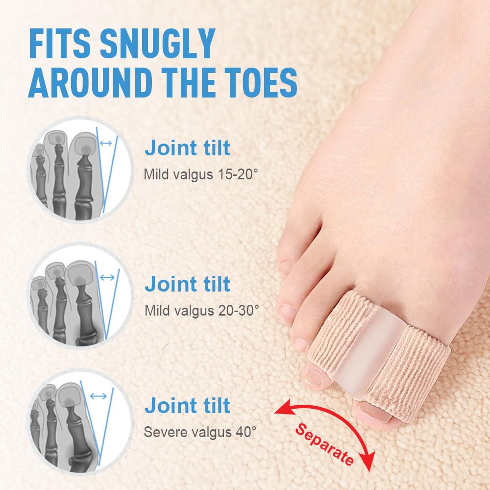 Toe Separators for Overlapping Toes, 2025 New Multifunctional Gel Toe Spacers Corrector with 2 Loops, PremiumToe Straightener for Women and Men Foot Care Tool (12 Pcs, S)