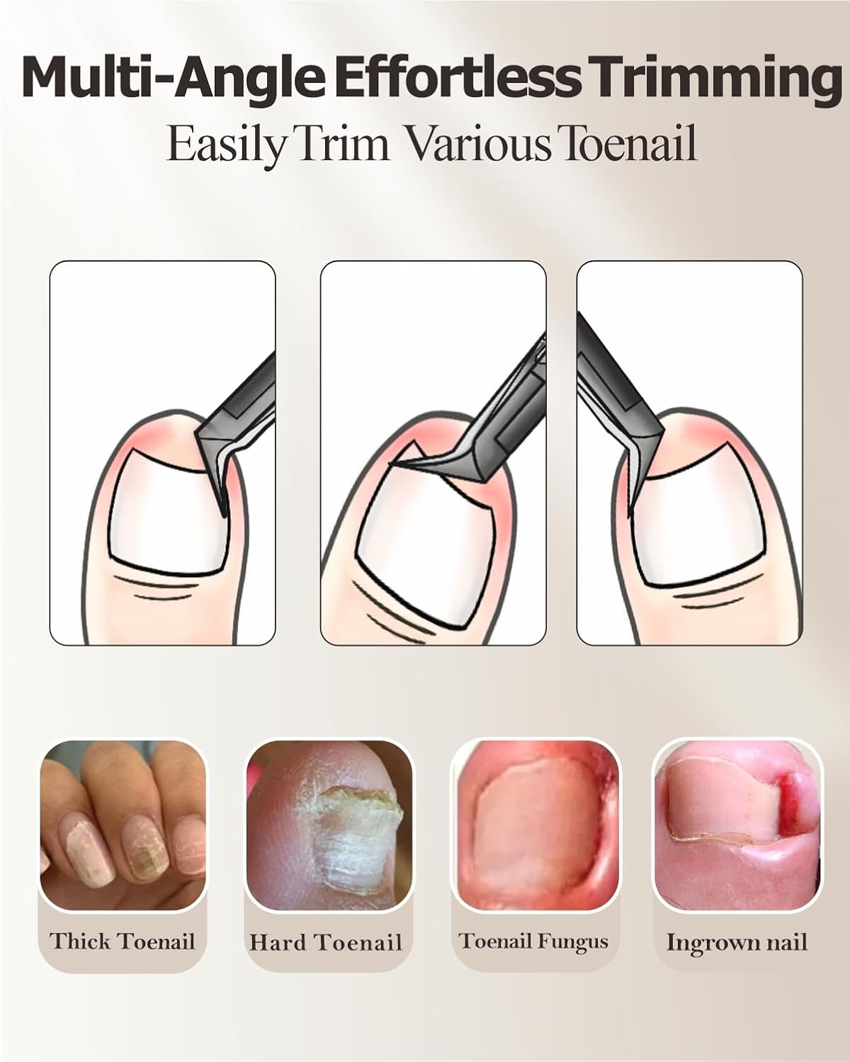 Toenail Clippers for Ingrown & Thick & Hard Nails - Ingrown Toenail Clippers for Men Women Seniors - Fingernail Toe Nail Clippers with Sharp Blades/Effort-Saving Spring/Long Non-Slip Handle Design