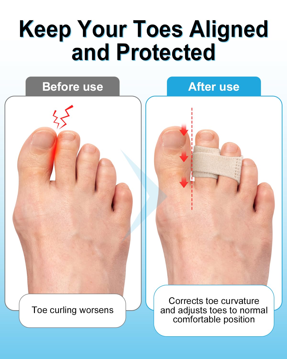 8 Pack Hammer Toe Corrector, Toe Straighteners for Women & Men, Fabric Buddy Wraps for Broken Toes, Hammer Toe Splint for Curled and Bent Toes(skin)