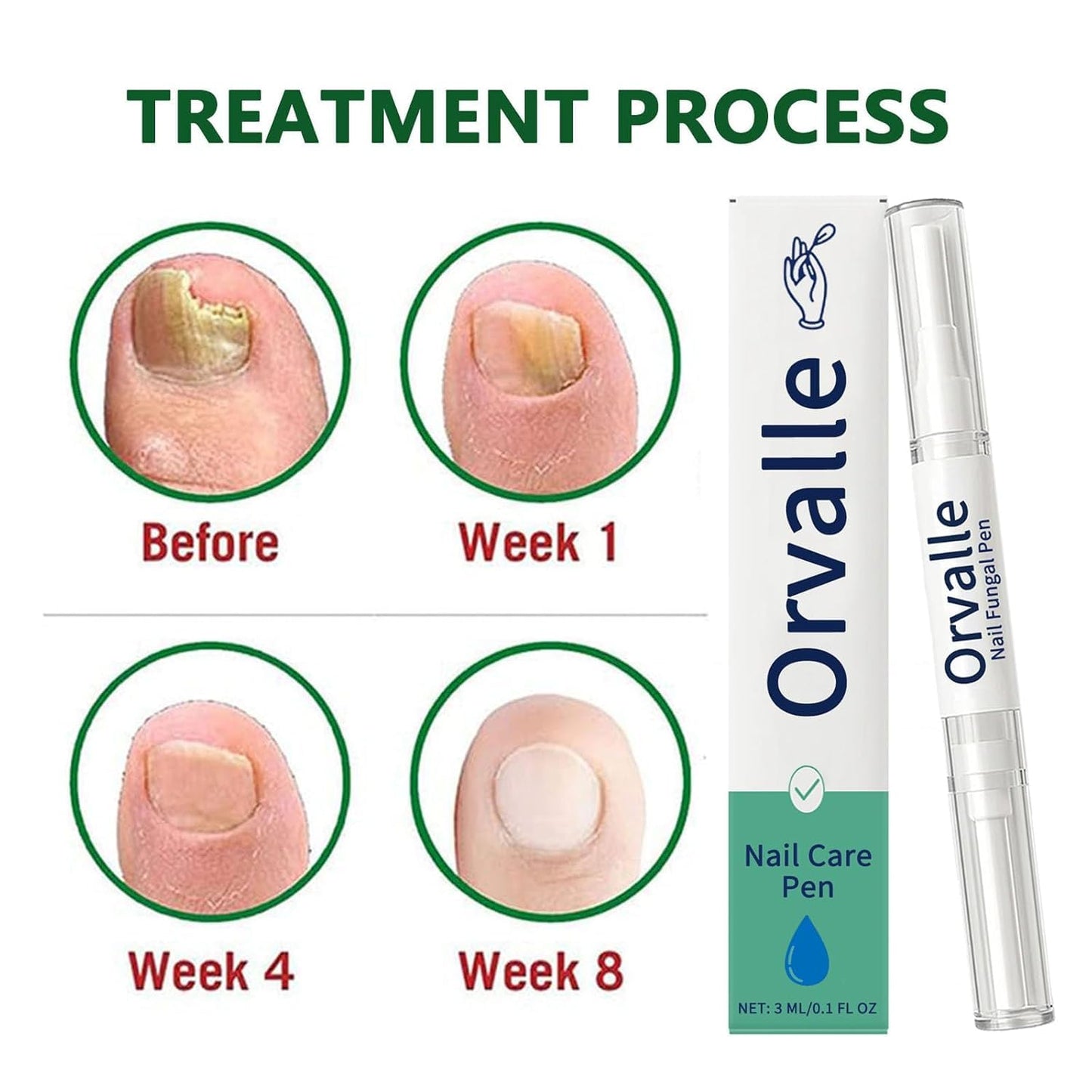 Orvalle Nail Fungus Pen, Nail Growth Treatment Repair Serum Twist Pen Activator for Repair & Strengthener(3PCS)