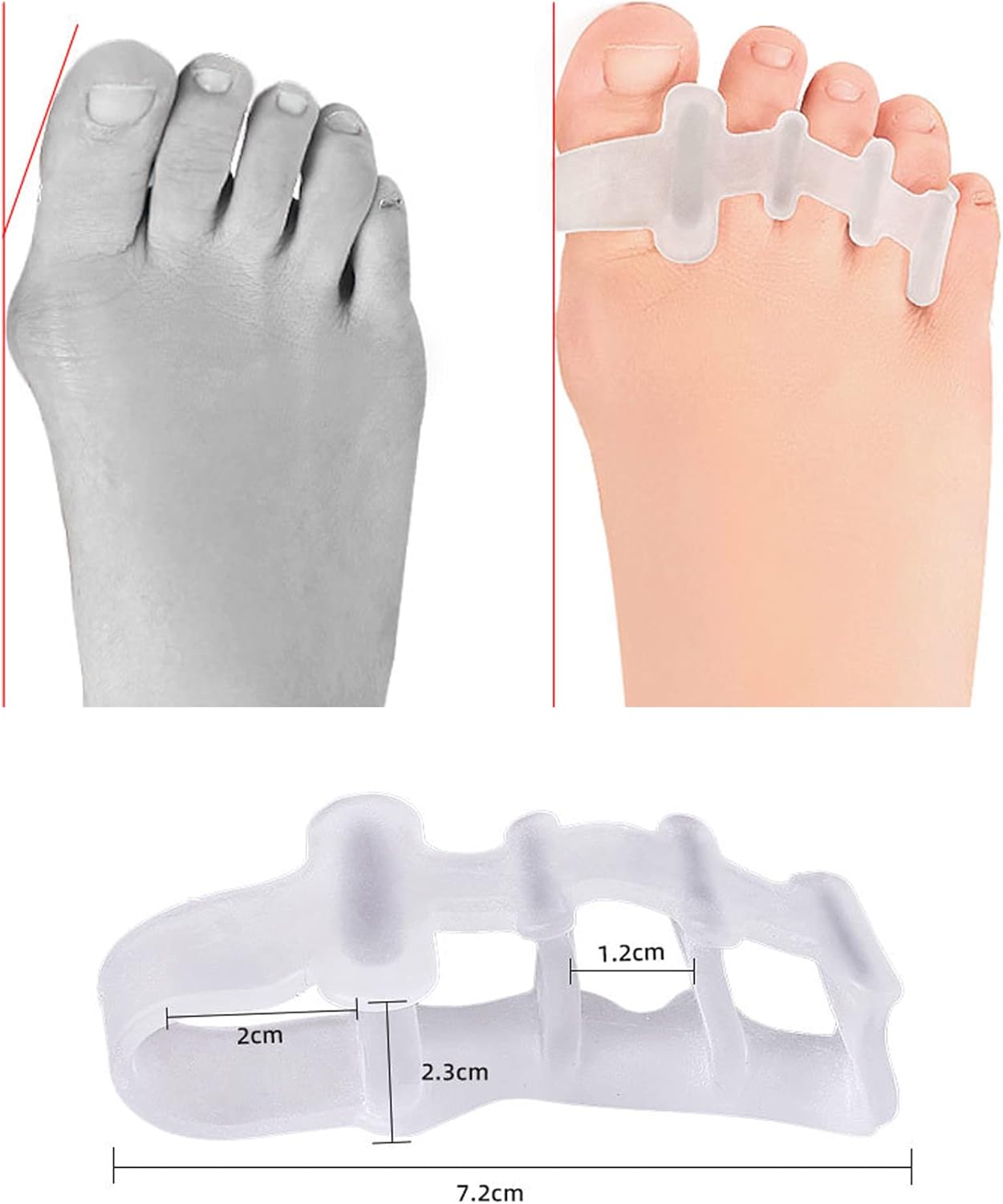 Gel Toe Separator, Toe Straightener for Nail Varnish Reusable Correctors for Overlapping Toes, Bunions, Hammer Toe, Pain Relief Toe Spacers, Pedicure Manicure Nail Art for Men and Women Toe Spreader