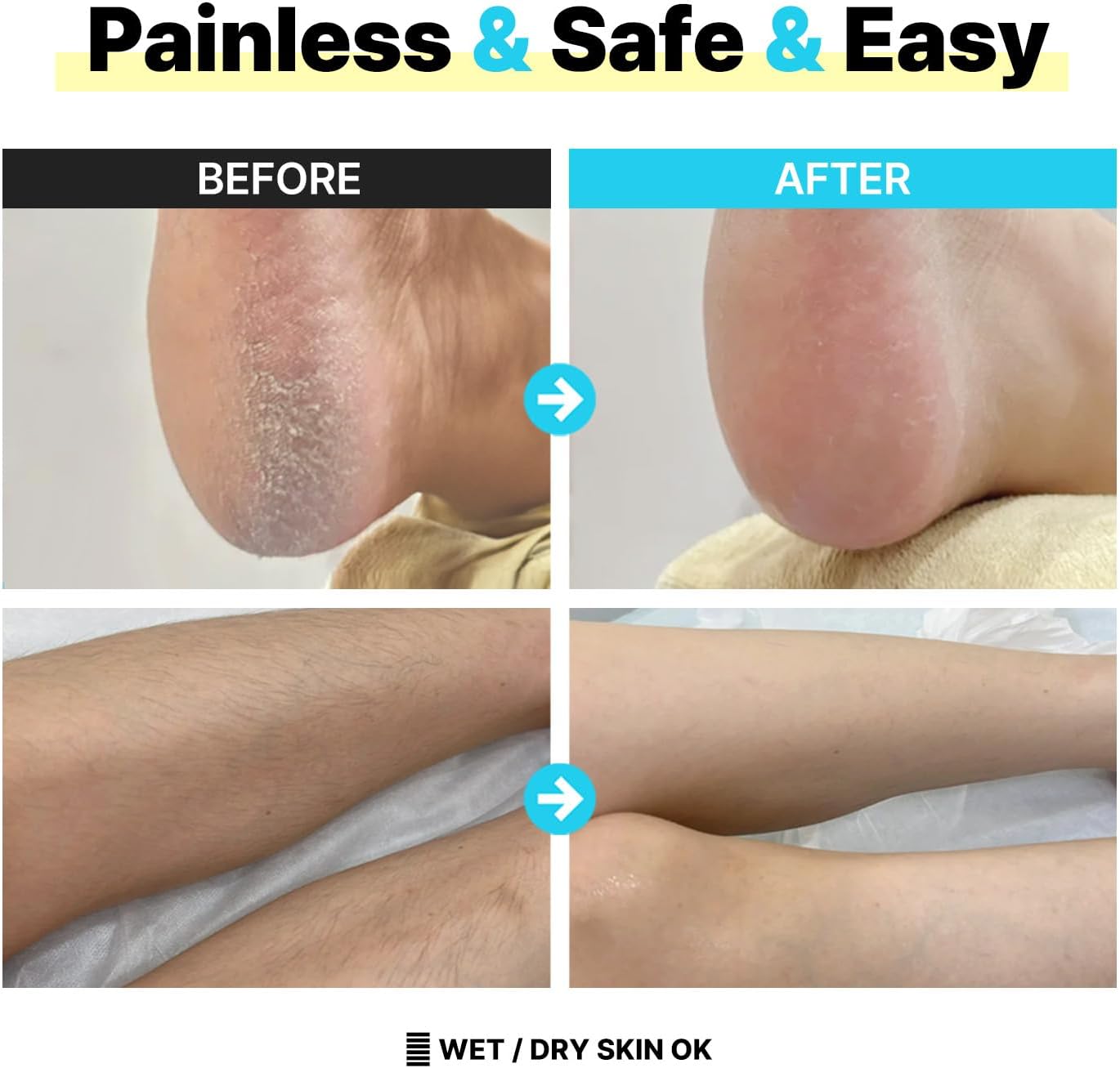 BODLOV Duo, Callus Removal and Hair Erase in ONE, Nano Glass, Foot File, Wet and Dry Skin, Skin Painless and Safety, Water Washing, Ergonomic Design, Hygiene to USE, Dual Care, Exfoliation, 2 in 1