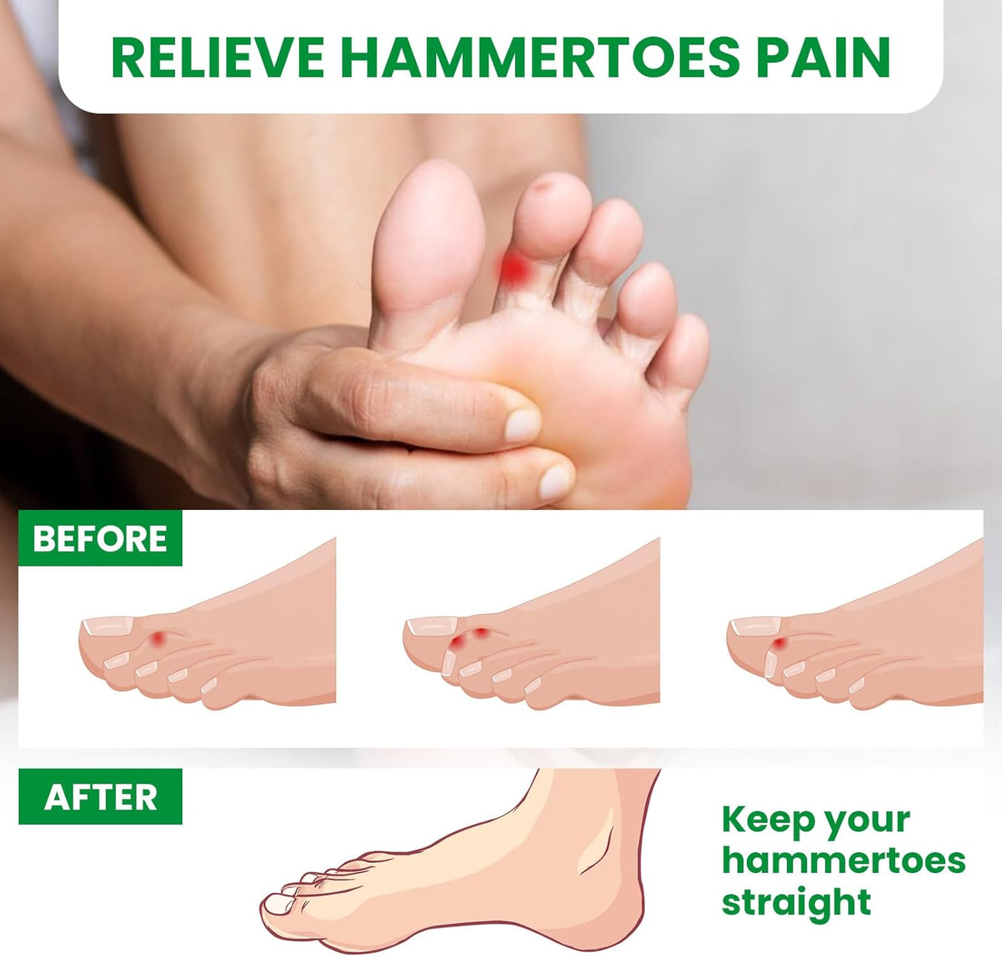 Bukihome Hammertoe Corrector - 6 Pack Toe Splints - Soft Gel Toe Straighteners - Realign Bent, Curled, Crooked, Claw, Hammer Toes - Toe Corrector for Men and Women, 3 Different Sizes (White)