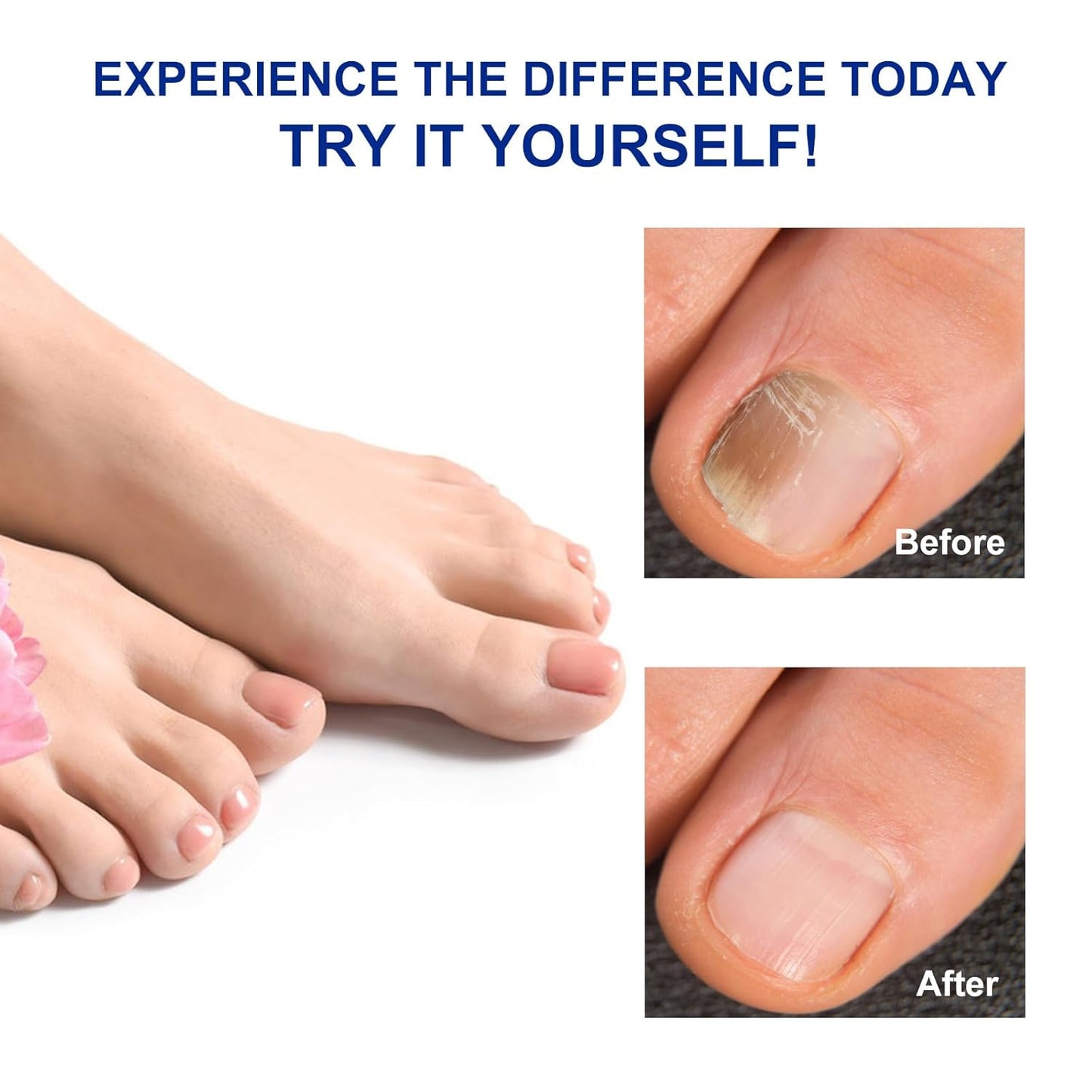 Toenail Treatment Extra Strength - 32 Pcs Nail Patches, 8-Hrs Overnight Nail Repair, Safe for Sensitive Skin, Easy to Apply