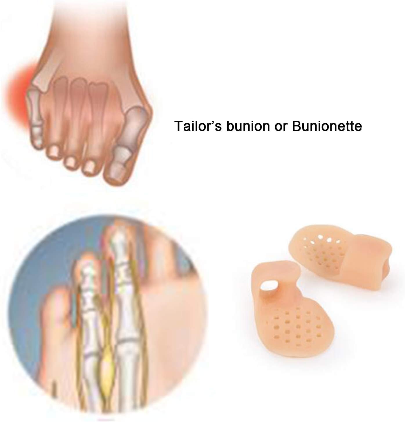 5 Pairs-Pinky Toe Cushion Splint, Gel Toe Separators, Little Toe Straightener with Loop, Pinky Toe Separators for Men Women, Prevent Blisters, Corn, Pain Relief (5 Pairs-Skin)