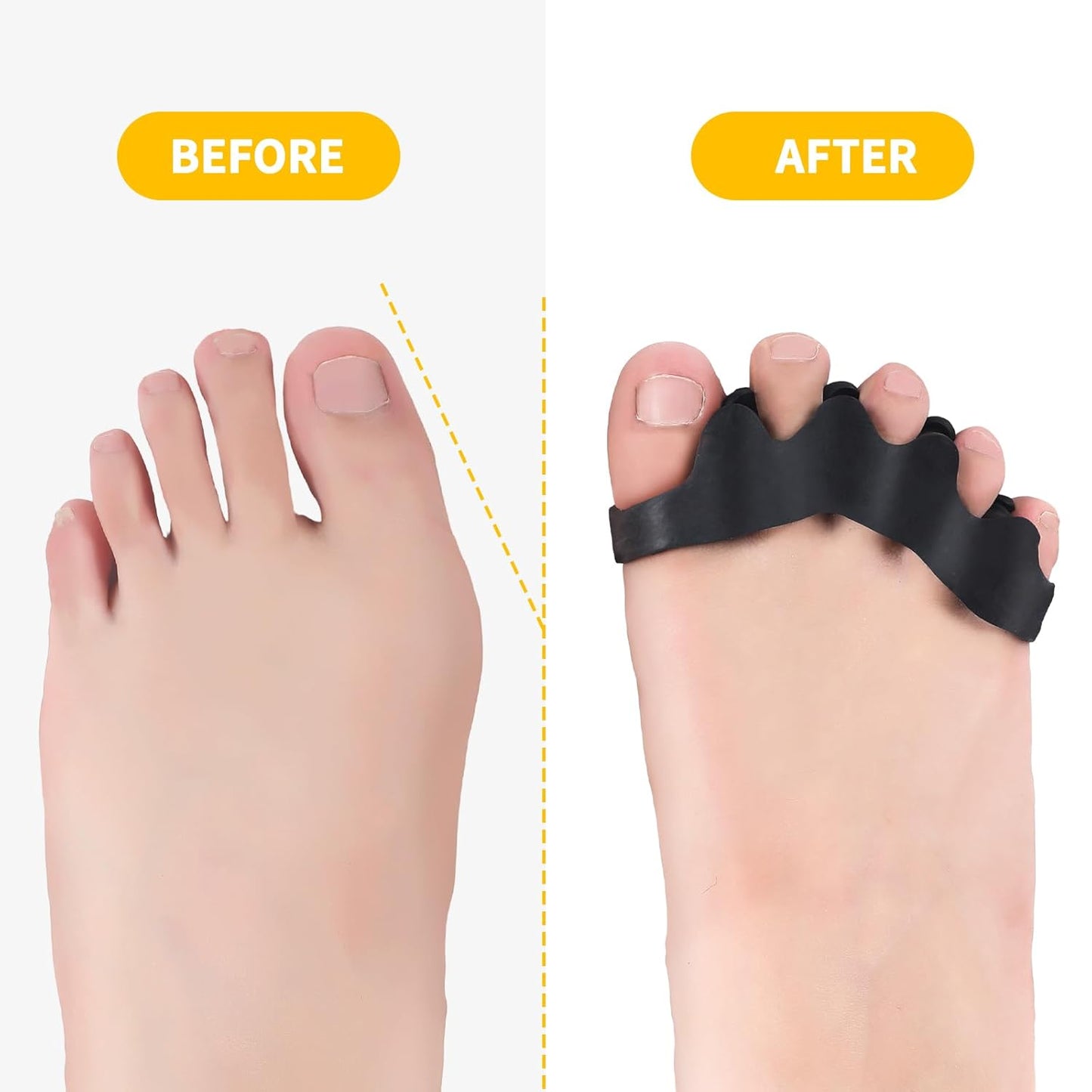 2 Pairs Adjustable Toe Separators for Men and Women, Toe Spacers Improve Balance and Toes to Their Natural Shape, Enhanced Athletic Mobility Applied for Walking, Running, Yoga Practice