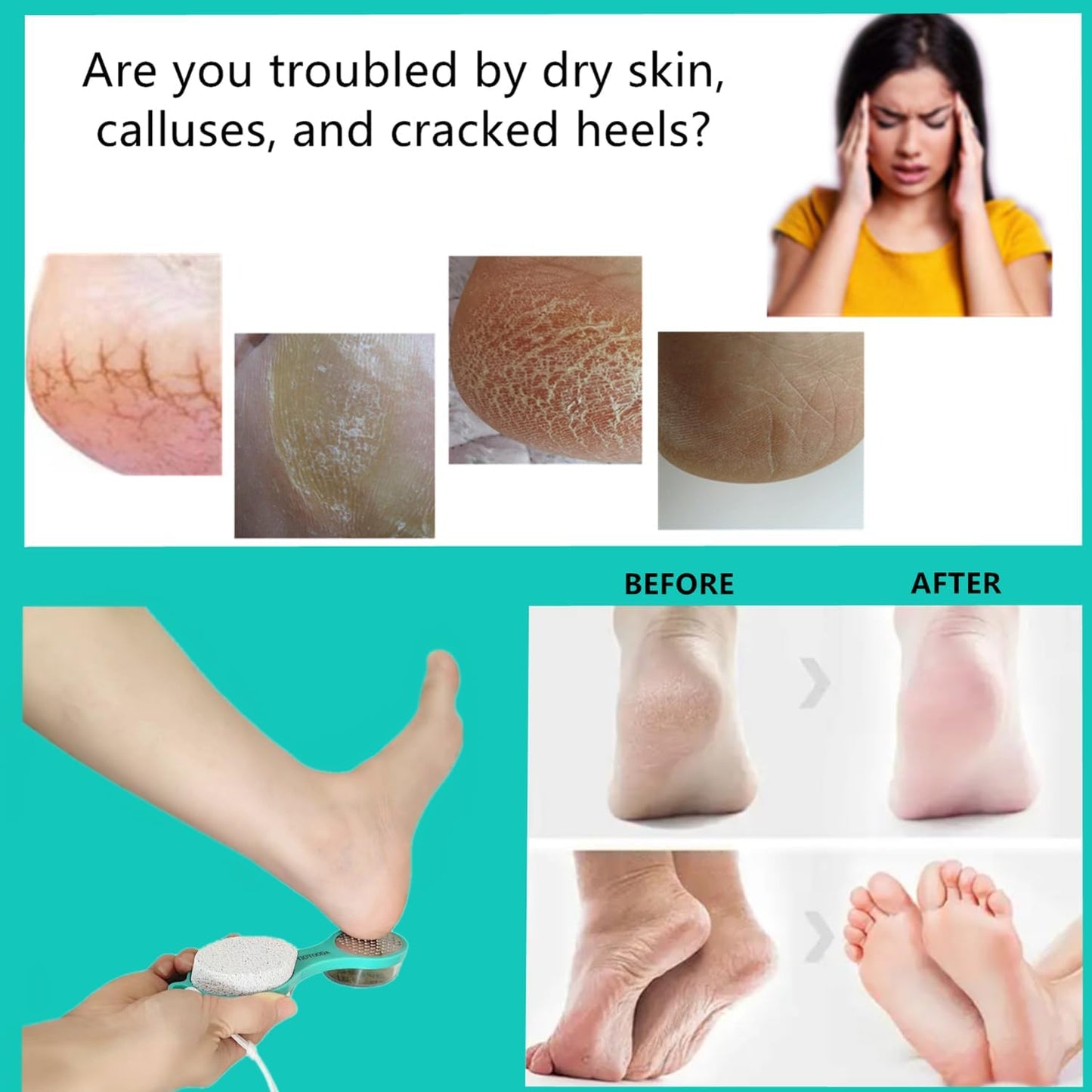 Foot File Callus Remover 5-in-1, 2 Pcs Feet Scraper Pedicure Tools with Pumice Stone, Scrubber Brush, Stainless Steel Foot Rasp and Sand Paper Debris Catcher, Multi Purpose, Pink Cyan