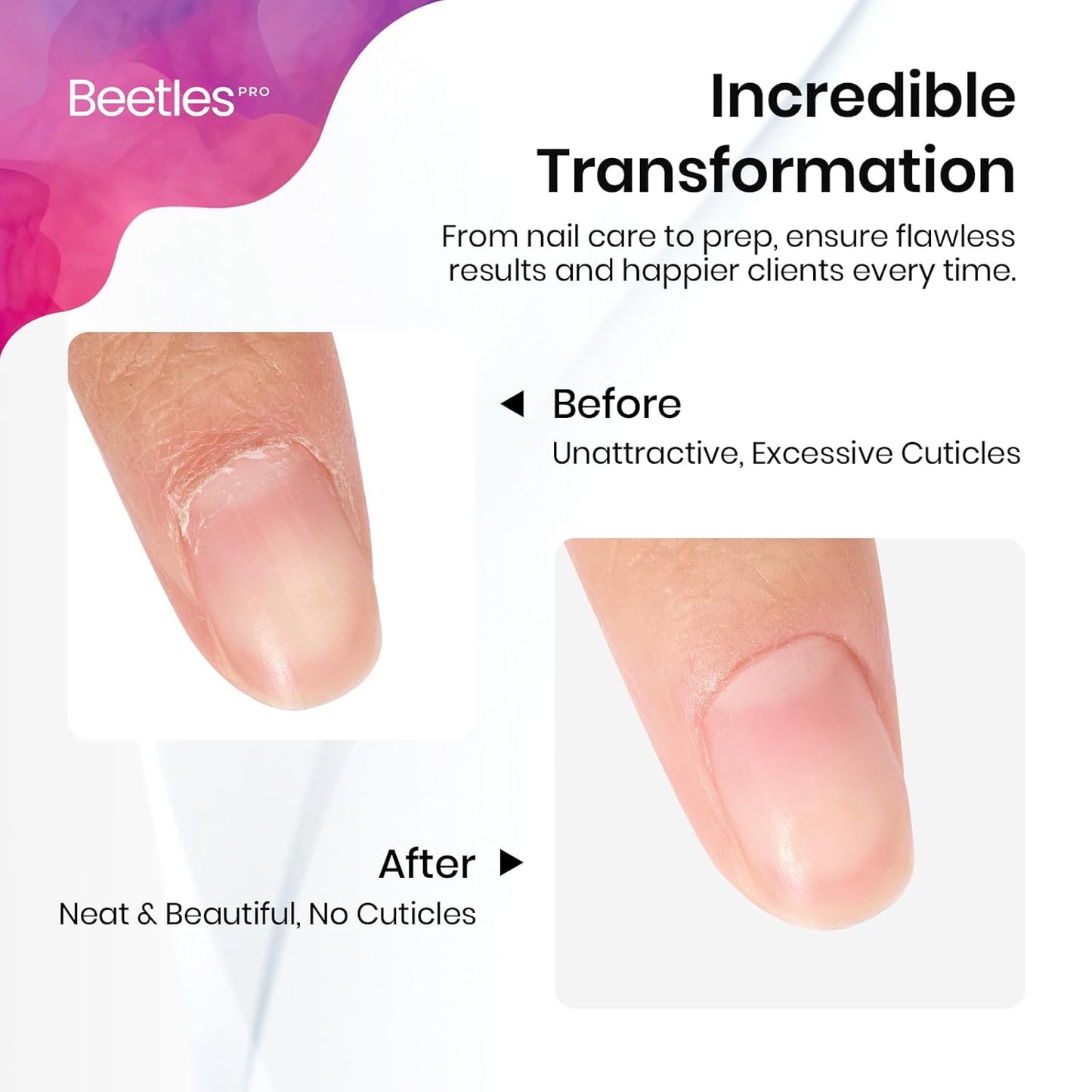 Beetles Dual-End Nail Pusher & Cuticle Cleaner - 14mm Serrated Edge & 5mm Curved Blade, Ergonomic Anti-Slip Handle, Professional Manicure Tool for Nail Care