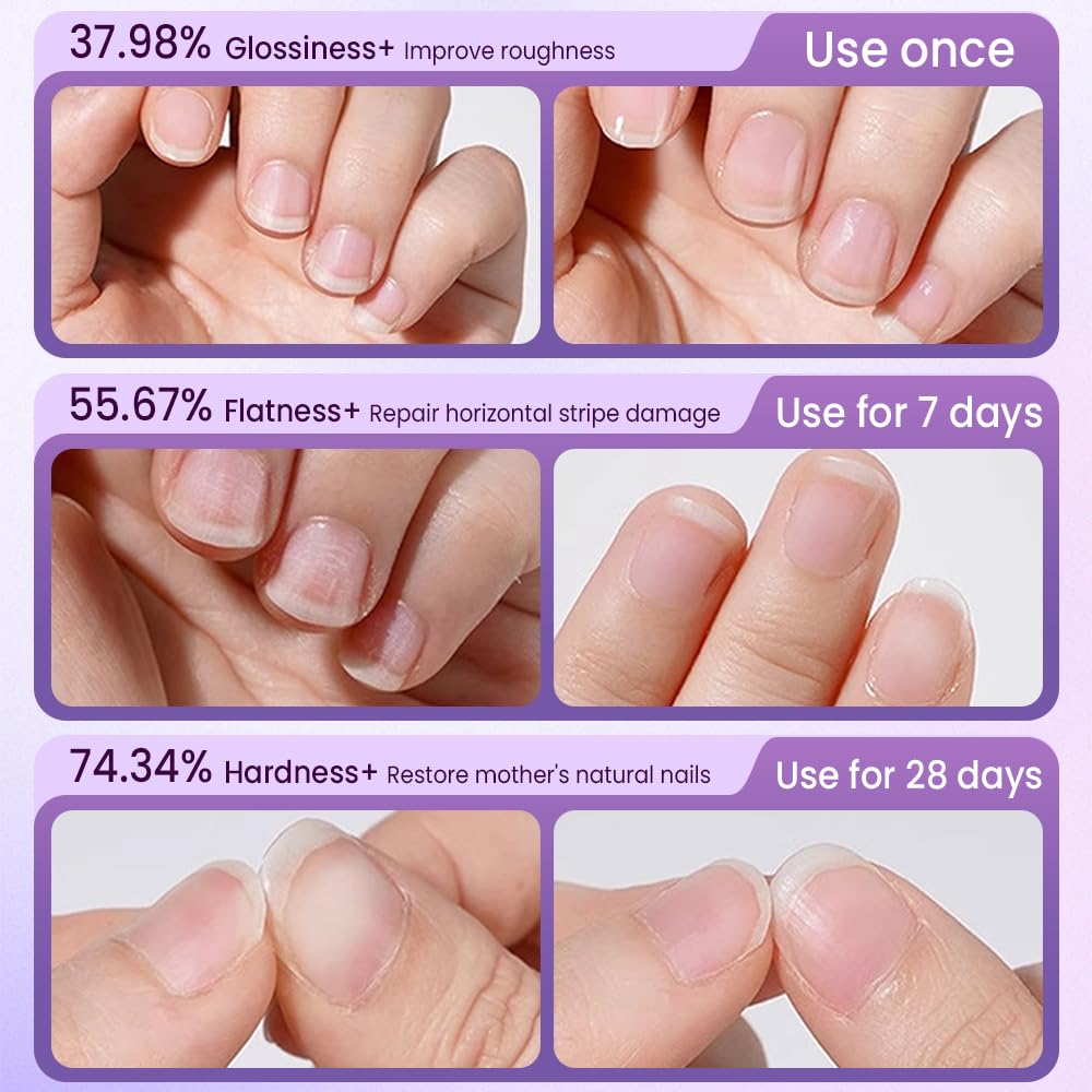 Yilia 3-in-1 Nail Care Pen, Cuticle Oil Pen & Pusher with Ceramic Tip, Moisturizes, Strengthens & Brightens Nails (3 Pack)