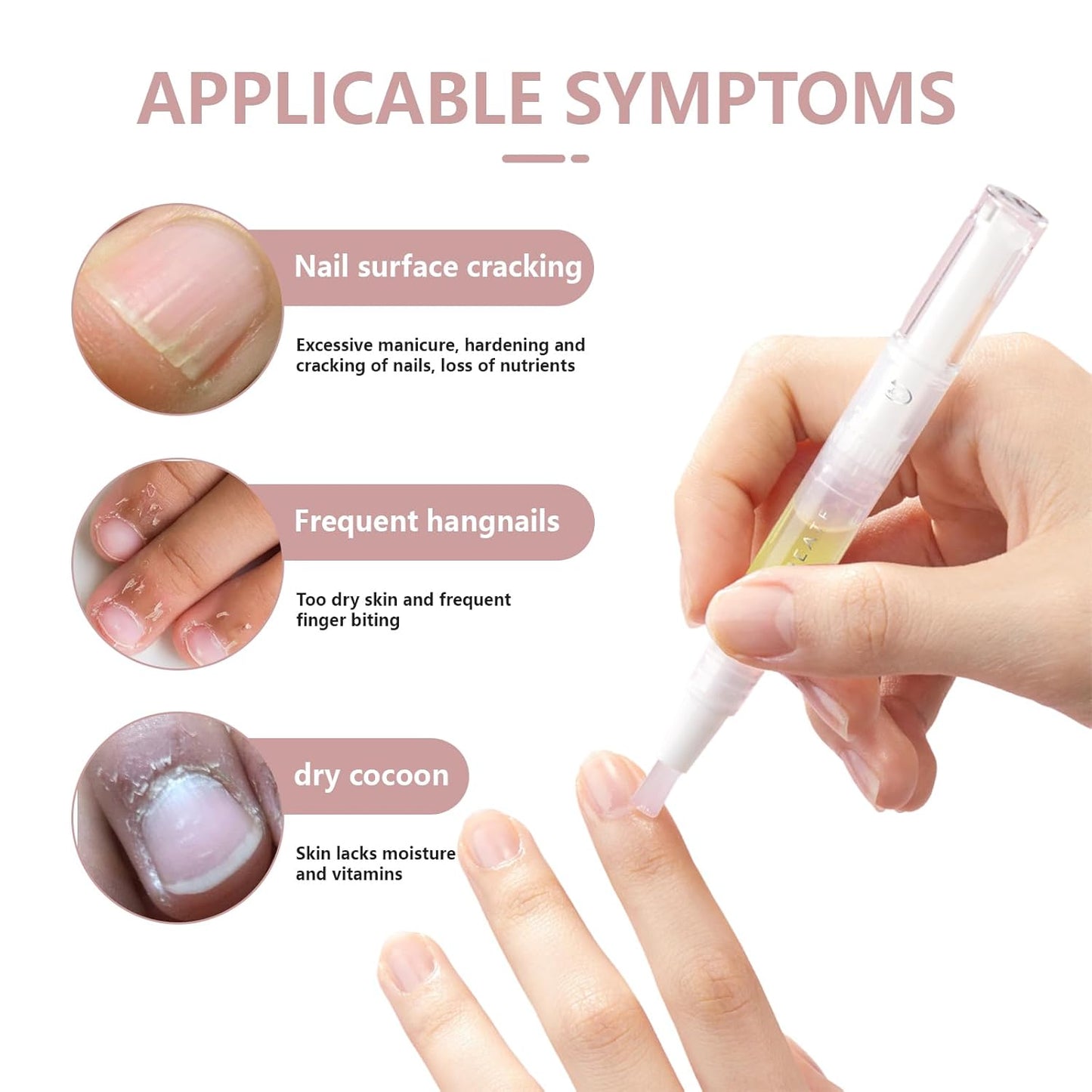 Cuticle Oil Pen， Nail Growth and Strengthener，Nail Growth Oil，Nail Hardener for Damaged nails (1PC)