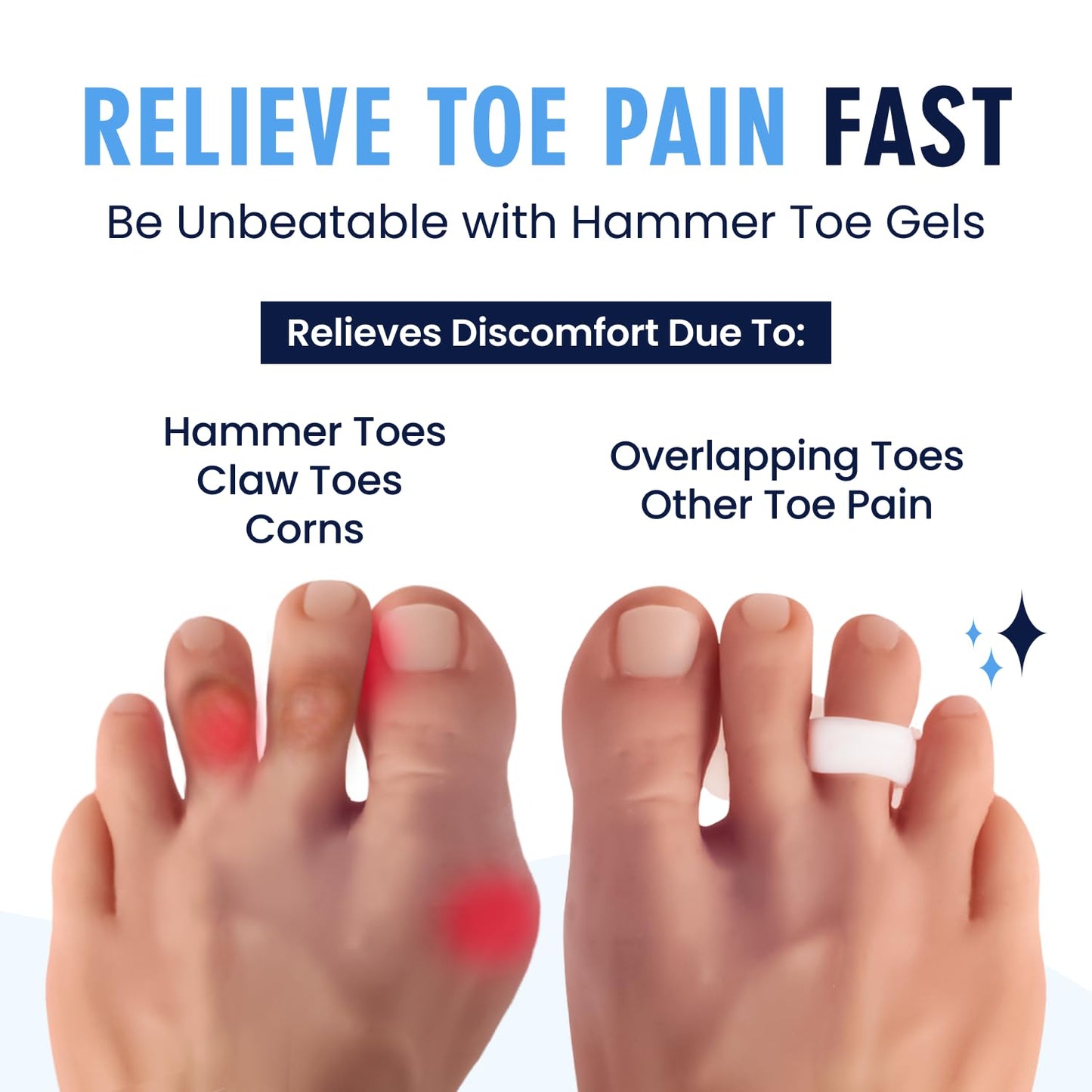 Dr. Frederick's Original Hammer Toe Corrector Gels - 2 Pairs - All-Day Relief for Crooked & Overlapping Toes - Soft Cushioning - Symptomatic Support for Toe Alignment - White - 1 Loop Design
