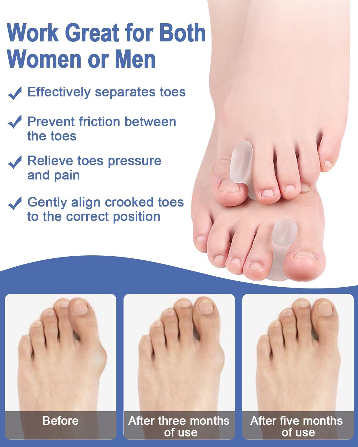 14 Pack Gel Toe Separators Silicone Spacers Soft Bunion Pads for Women Men Foot Pain Relief, Crooked, Overlapping Toes, Hammertoe Corrector(6L+8S)