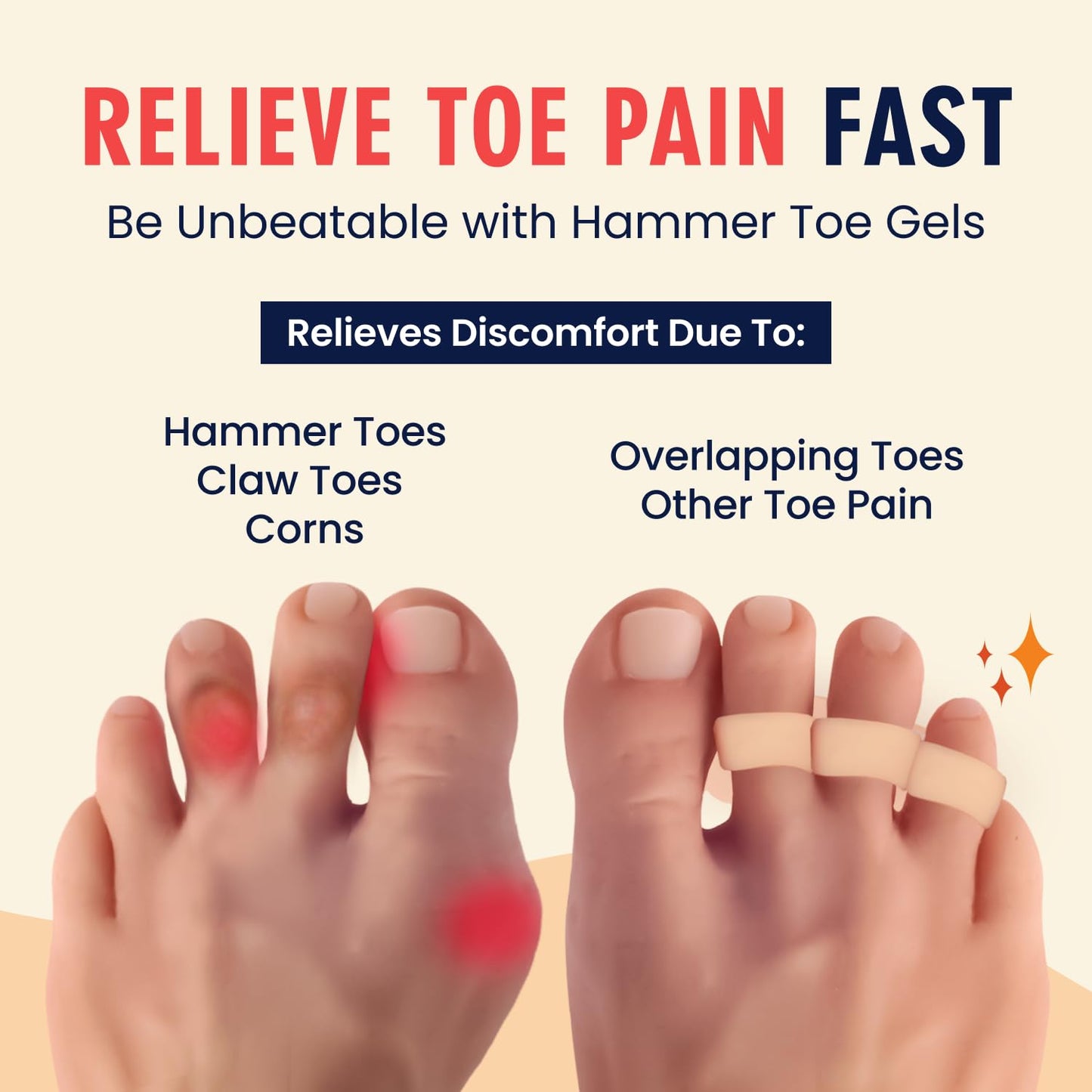 Dr. Frederick's Original Hammer Toe Corrector Gels - 2 Pairs - All-Day Relief for Crooked & Overlapping Toes - Soft Cushioning - Symptomatic Support for Toe Alignment - Beige - 3 Loop Design