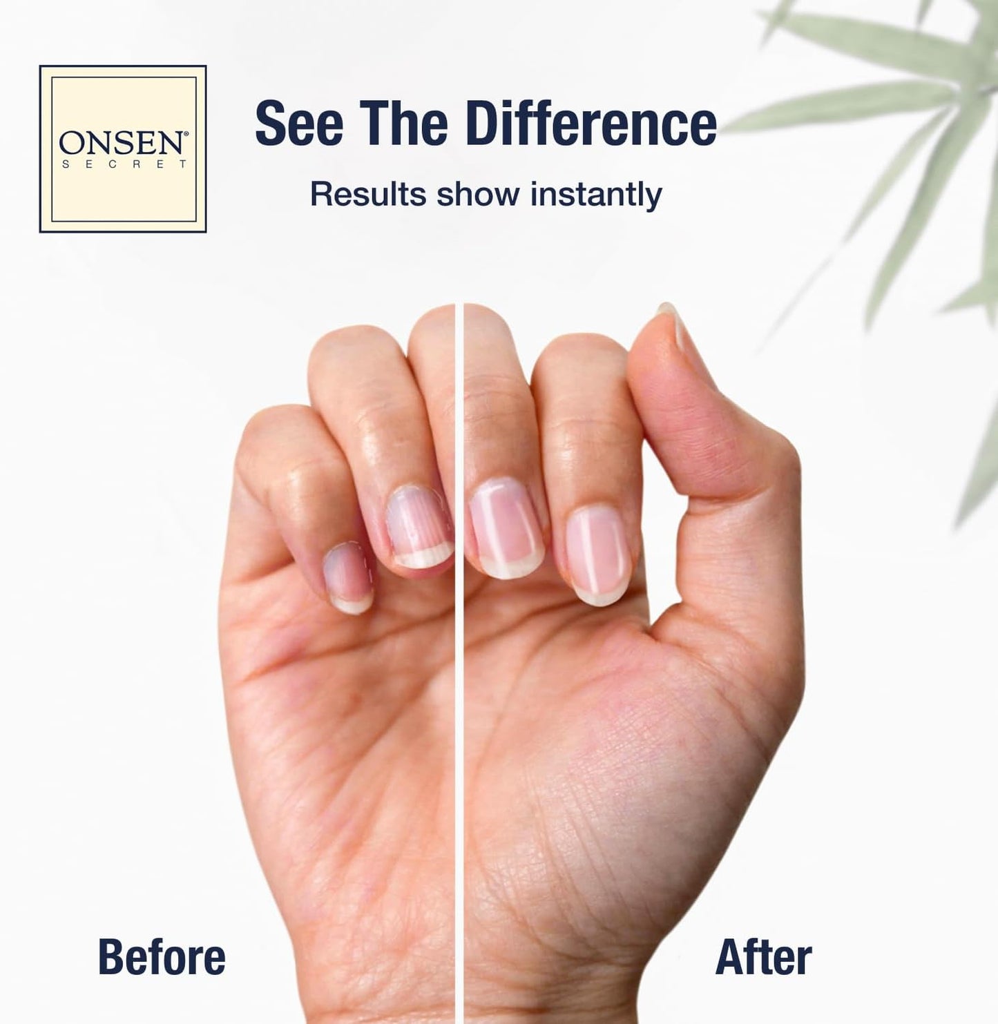 Onsen Secret Ultimate Nail Reboot Kit - Includes Cuticle Oil & Anti Aging Hand Lotion, Professional Nail File and Buffer, 3-Way Block w/Replacement Pads, Nail Strengthening Cuticle Cream