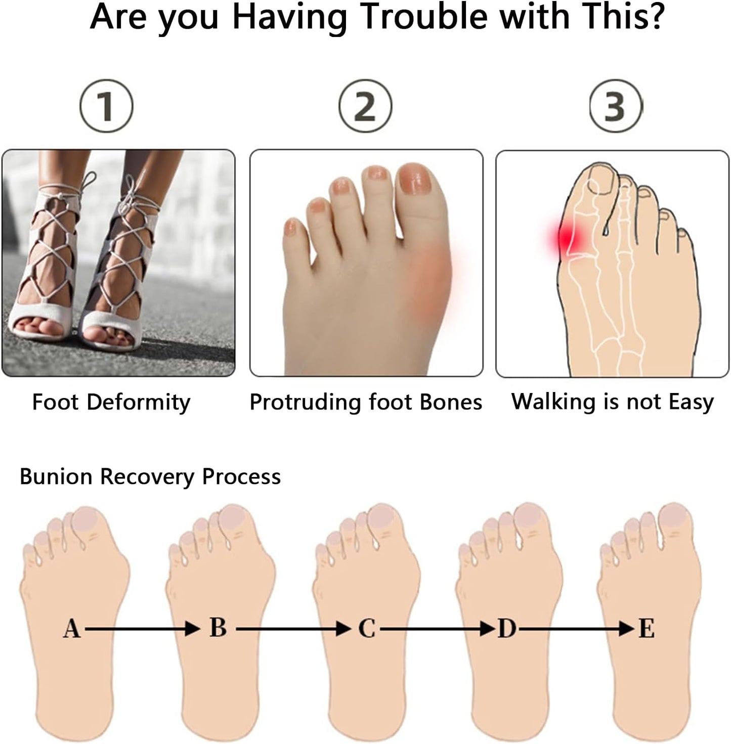 Silicone Toe Spreaders for Men & Women - Correct Curled Toes, Bunion & Hammer Toe Support, Reusable & Washable Adjustable Unisex Toe Spacer（4 Pack） (Skin Tone + Blue)