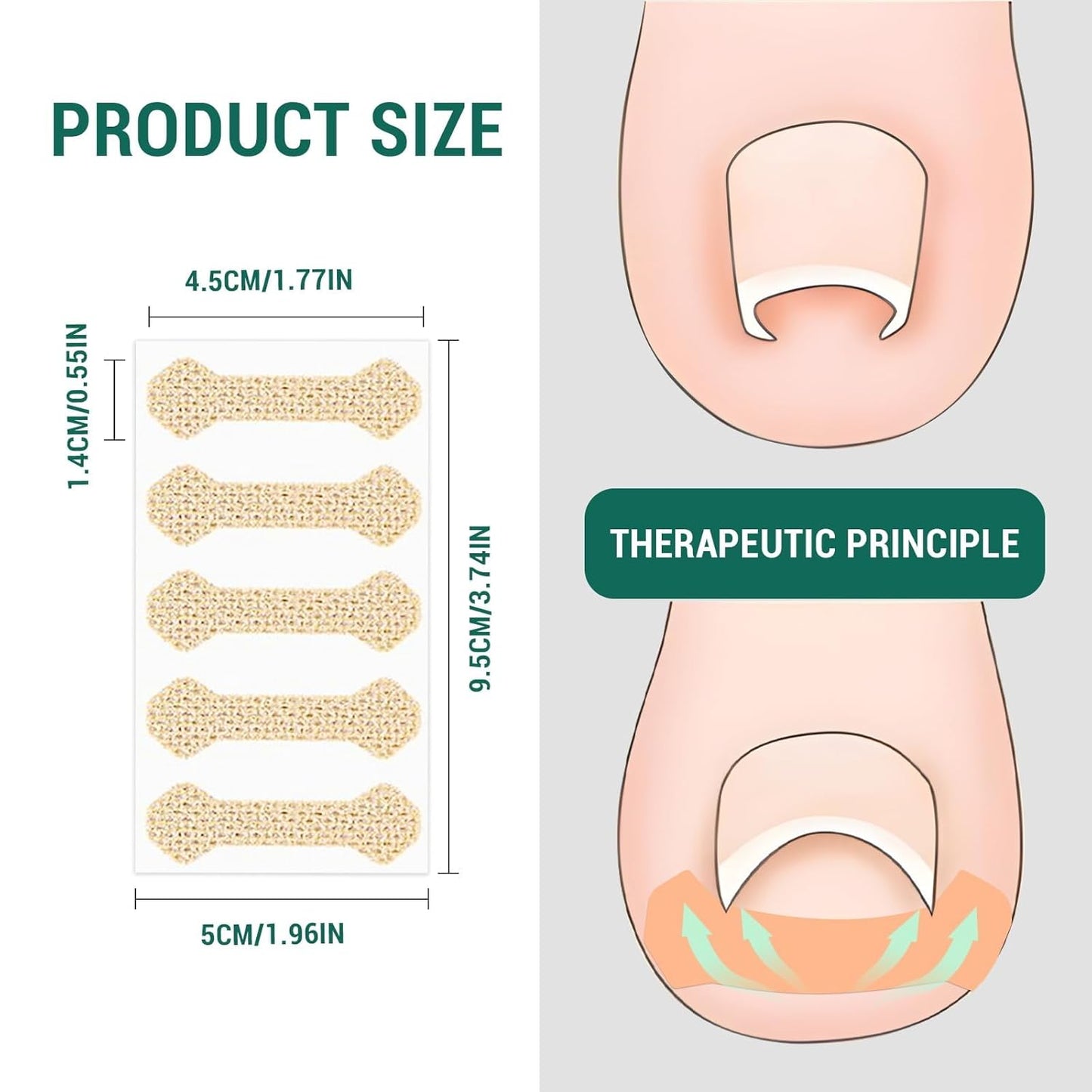 Ingrown Toenail Treatment, 60Pcs Breathable Ingrown Toenail Strips,Painless Ingrown Toenail Tool, Professional Pedicure for Ingrown Toenail, Toenail Corrector Patch