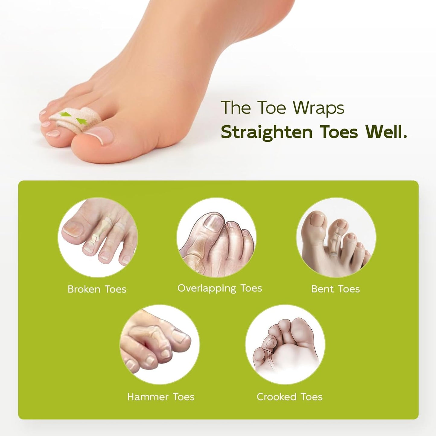 Bukihome Hammertoe Corrector - 10 Pack Toe Straighteners - Broken Toe Wraps - Realign Bent, Curled, Crooked, Claw, Hammer Toes - Toe Corrector Splints for Men and Women (5 Large + 5 Small, Beige)
