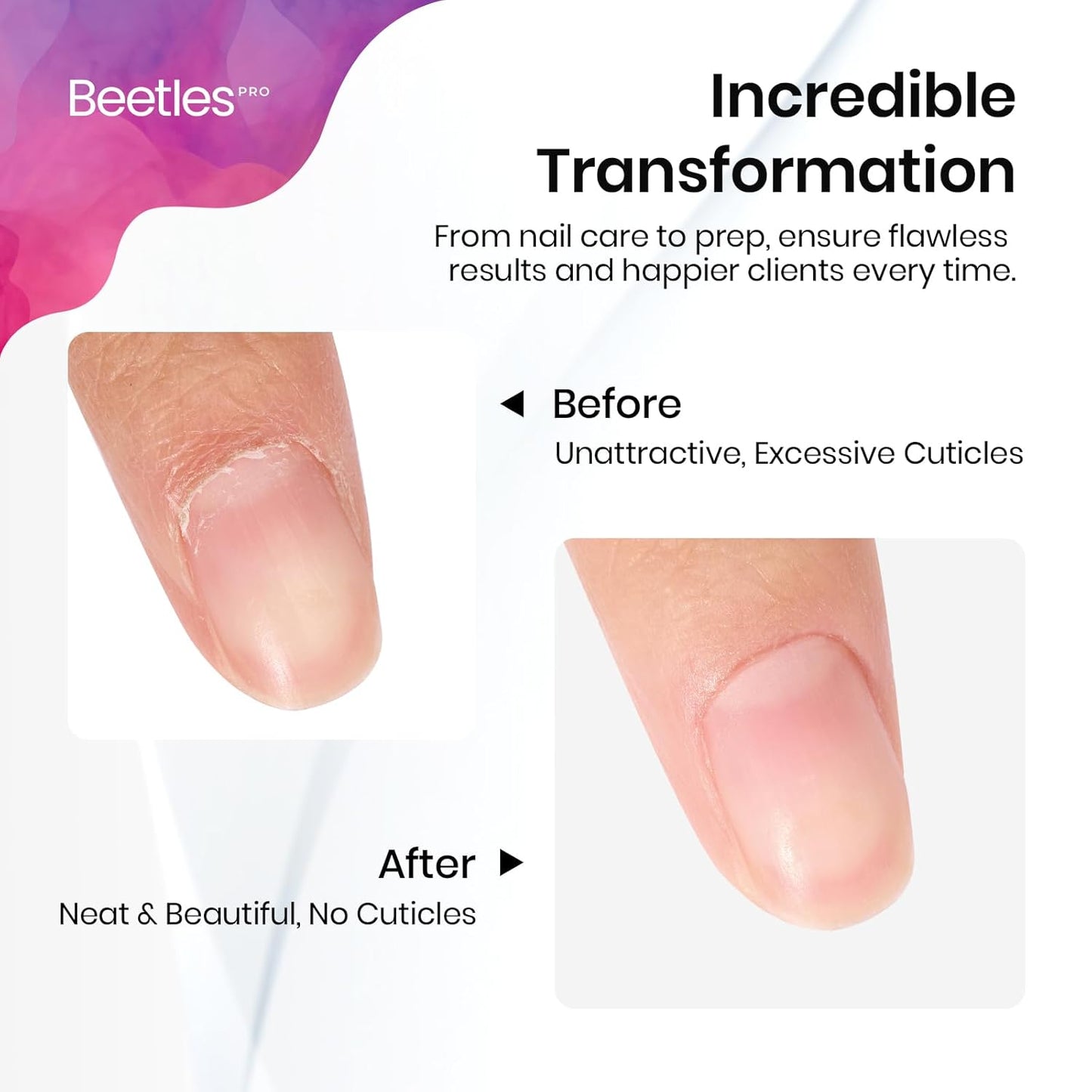 Beetles Cuticle Pusher Gel Nail Polish Remover Tool for Fingernail Polish Nail Cuticle Cleaner Manicure Home Cuticle Trimmer Nail Cleaner