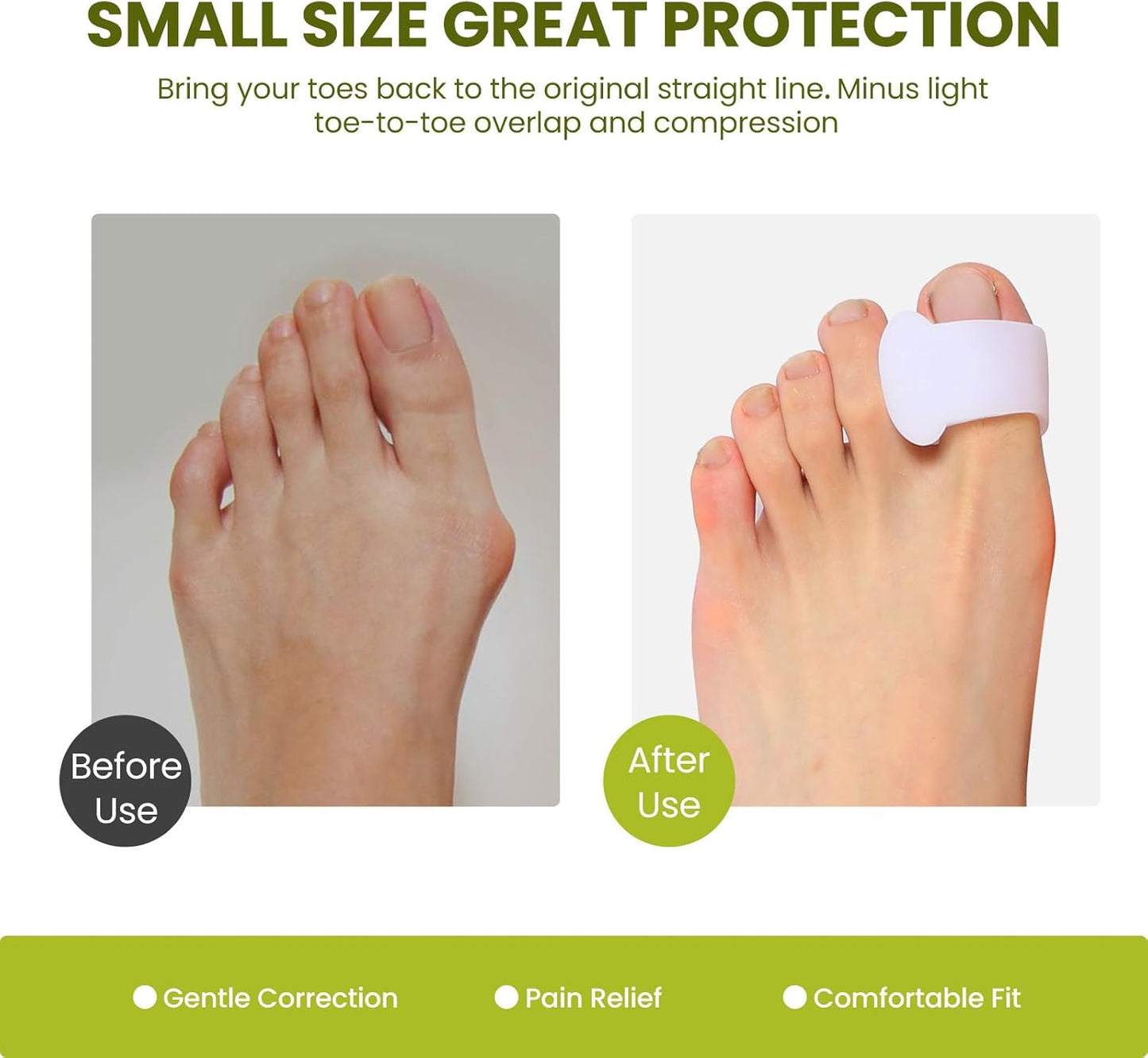 Bukihome Gel Toe Separators for Women -10 Pack Toe Spacers for Overlapping Toes, Bunions, Big Toe Alignment, Bunion Relief - Soft Silicone Toe Corrector for Men (Multi-Size)