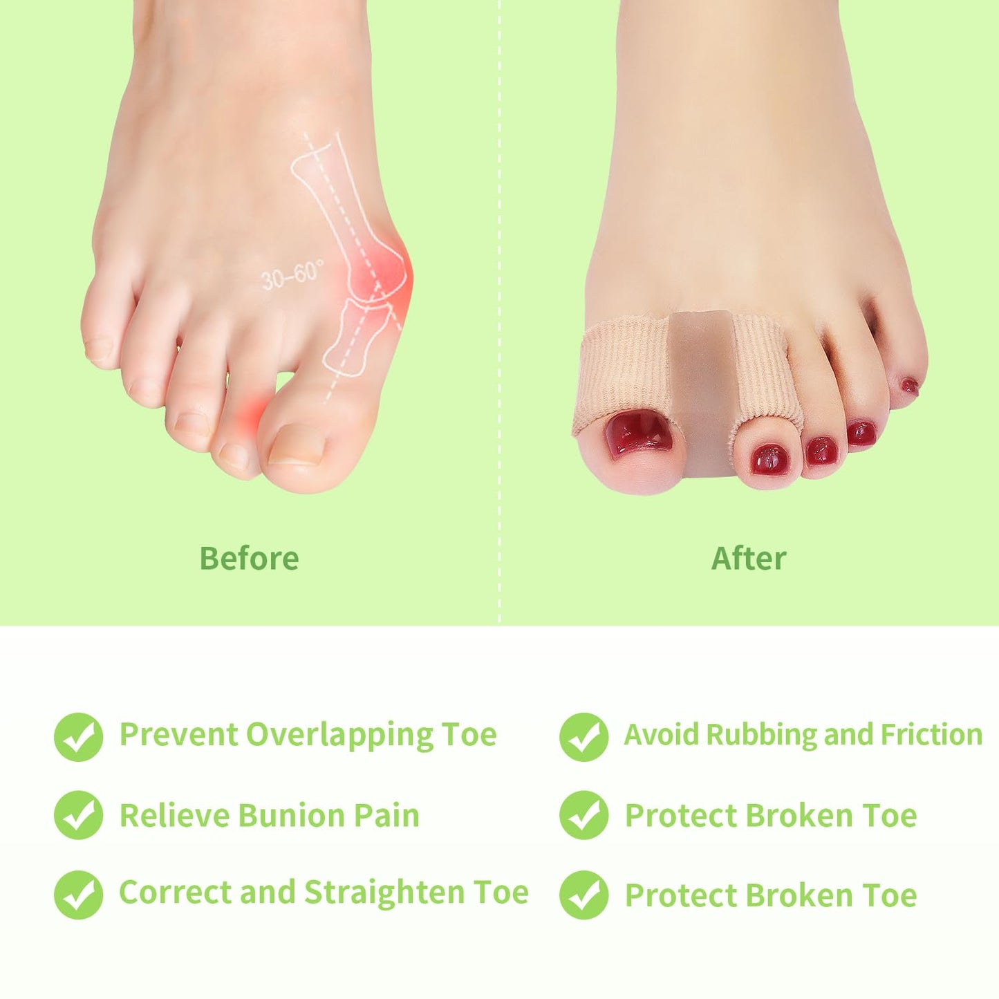 Niupiour Gel Bunion Toe Separators W/Fabric Lining for Big Toe, Silicone Toe Spacers Bunion Correctors for Overlapping Toe, Breathable Toe Corrector Protector for Women and Men, Relieve Foot Pain
