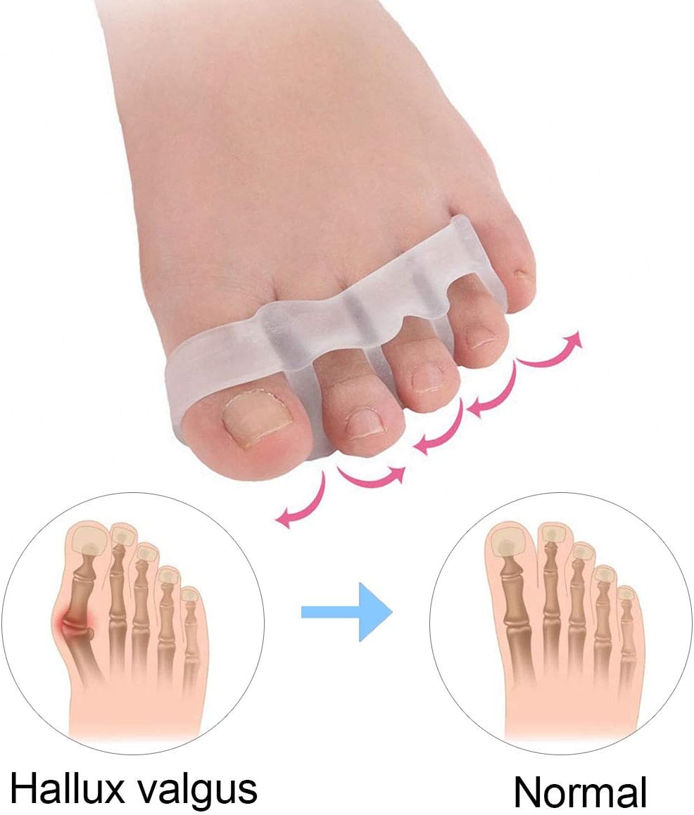 Gel Toe Separator, Toe Straightener for Nail Varnish Reusable Correctors for Overlapping Toes, Bunions, Hammer Toe, Pain Relief Toe Spacers, Pedicure Manicure Nail Art for Men and Women Toe Spreader