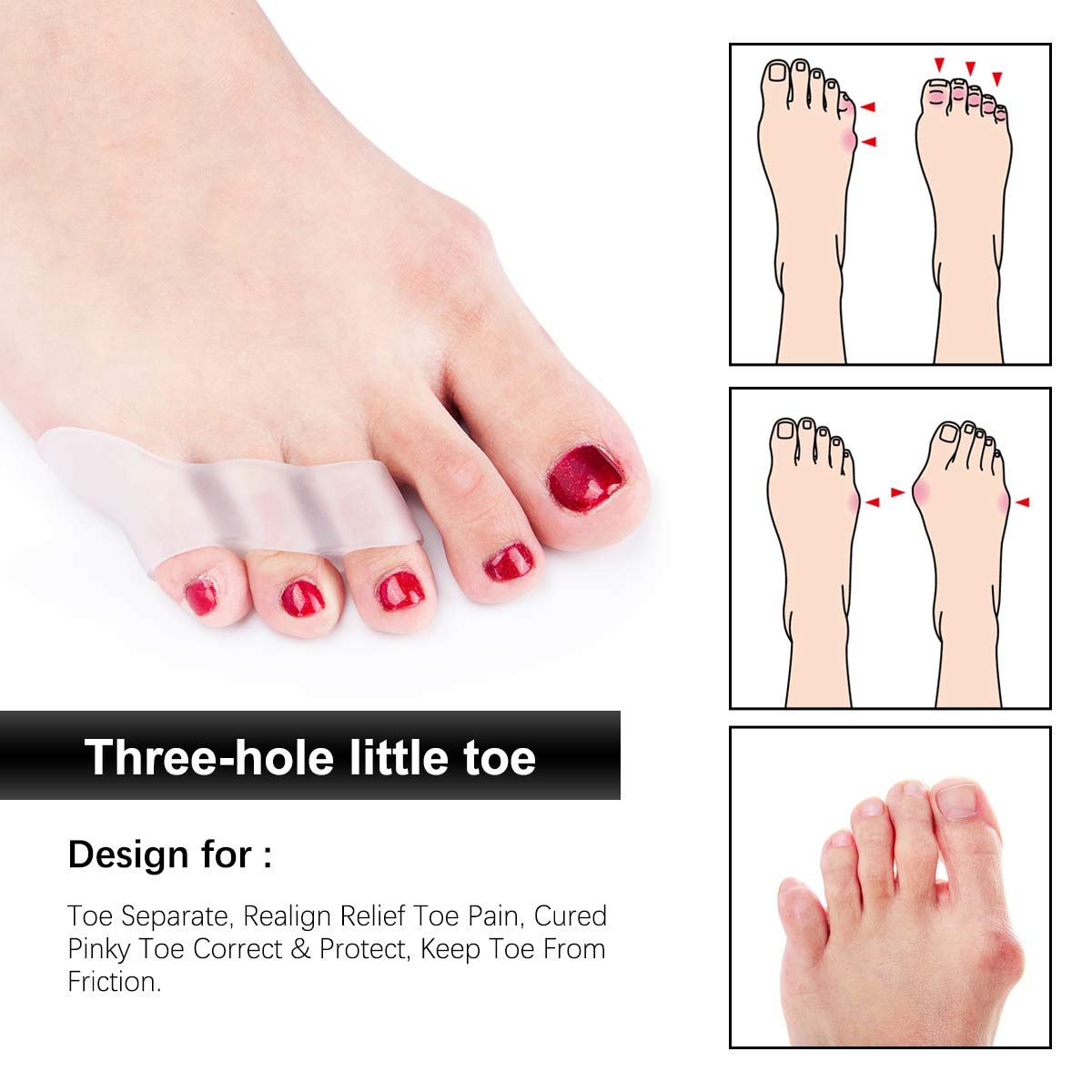 Toe Spacers, Pinky Toe Separators Straightener with 3 Loops for Curled Toes/Overlapping Toes/Foot Pain/Bunion Corrector and Bunion Relief for Men Women, 6 Pcs/ 3 Pairs