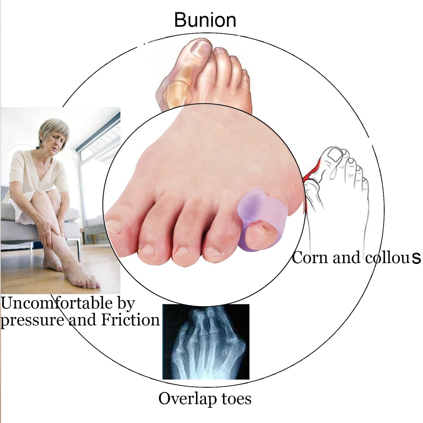 10 Pcs Pinky Toe Splint, Gel Toe Separators, Little Toe Straightener Hammer Toe for Men Women Walking, Running, Overlapping, Bunion Corrector and Bunion Relief, Small