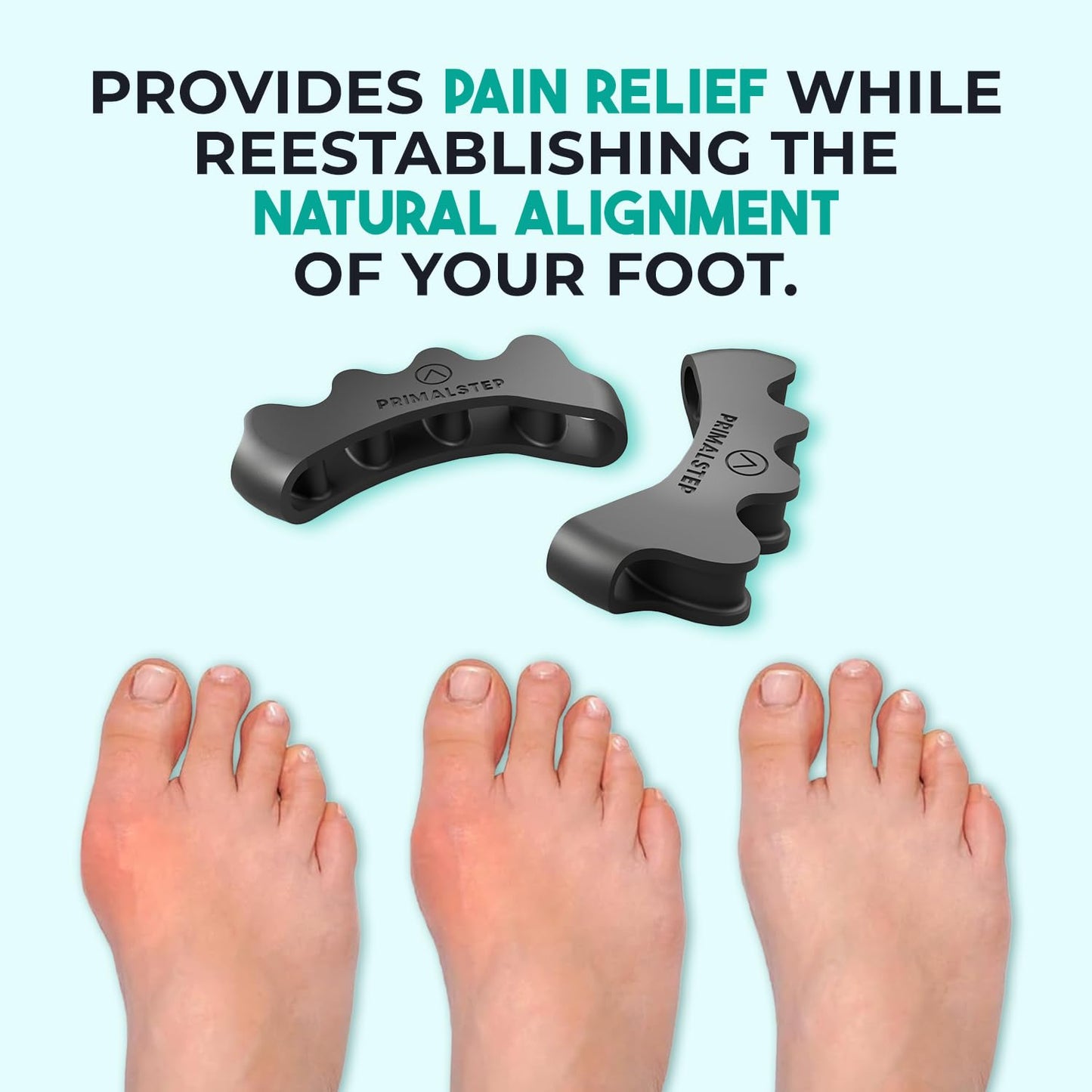 PrimalStep Toe Separators, Spreaders, Spacers, Straightener to Correct Toes for Men and Women, Bunion Corrector, Foot Pain, Plantar Fasciitis, Over 50% Thicker, Large