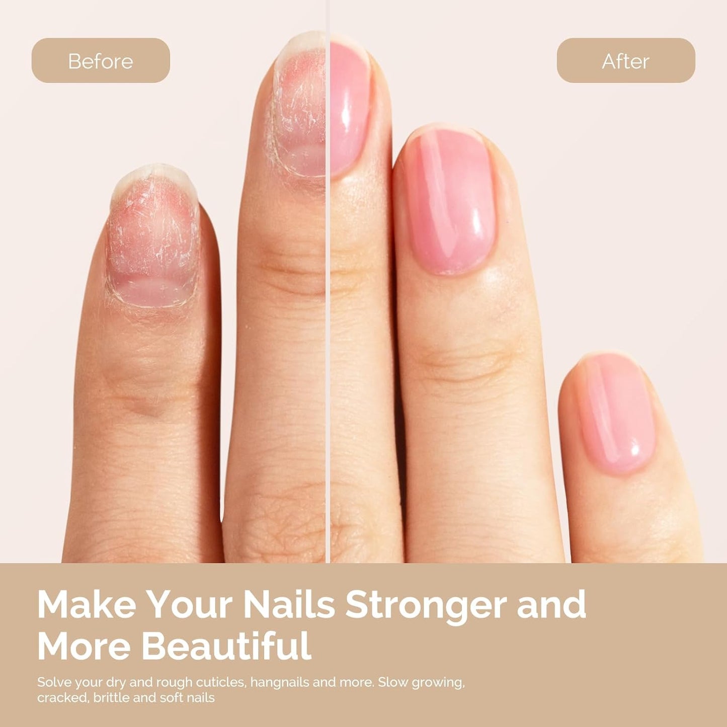 MelodySusie 15ML Cuticle Oil,Nail Strengthener with Jojobal & Vitamin E,Nail Growth that Repairs Cuticles & Promotes,Moisturizes & Conditions Dry Skin,Rose