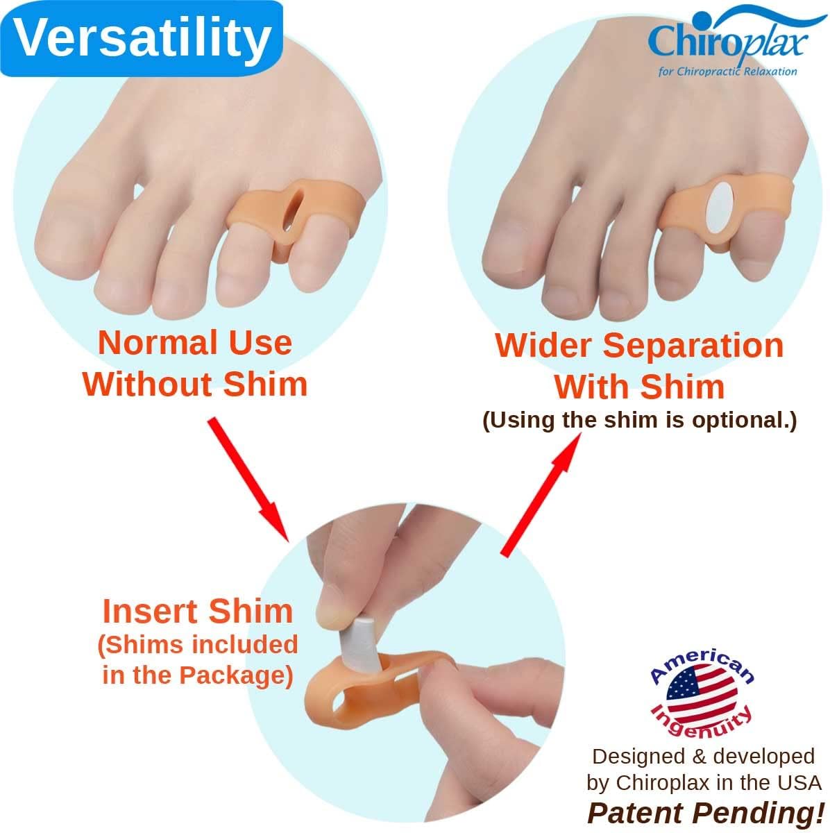 Chiroplax Tailor's Bunion Corrector Pads Bunionette Pain Relief Silicone Pinky Toe Straightener Separator Spacer Sleeve Cushion Splint Protector for Men & Women (4 Pads, Shims - Size Small)