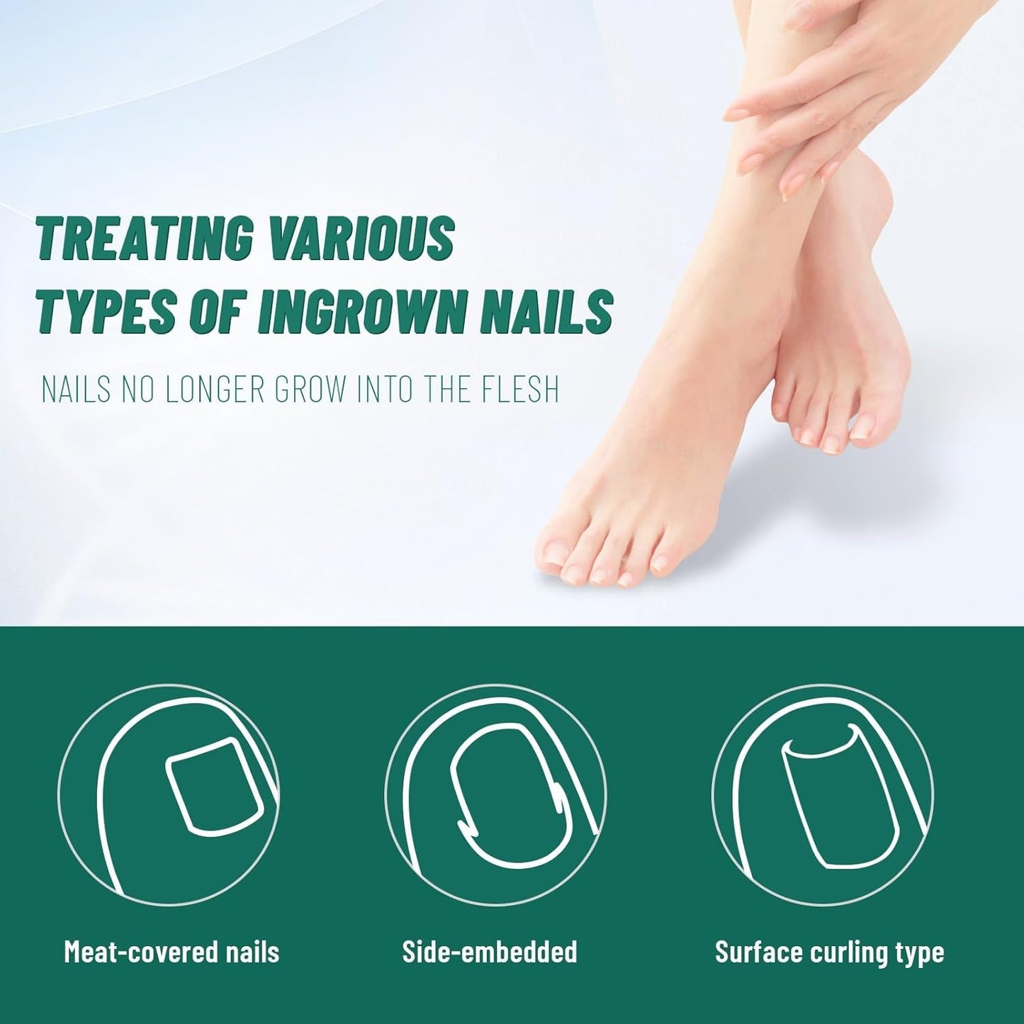 Ingrown Toenail Treatment, 60Pcs Breathable Ingrown Toenail Strips,Painless Ingrown Toenail Tool, Professional Pedicure for Ingrown Toenail, Toenail Corrector Patch