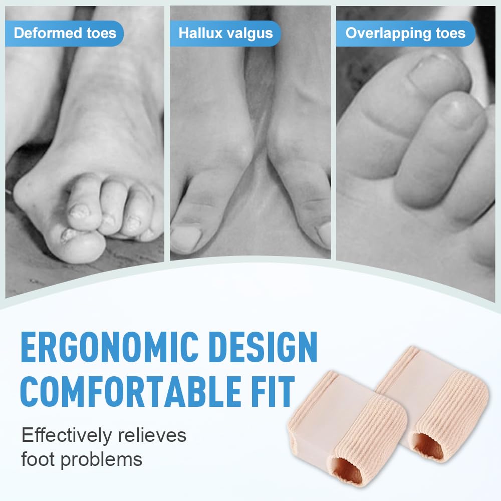 Toe Separators for Overlapping Toes, 2025 New Multifunctional Gel Toe Spacers Corrector with 2 Loops, PremiumToe Straightener for Women and Men Foot Care Tool (8 Pcs, L)