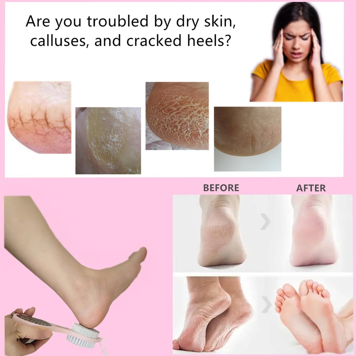 Foot File Callus Remover 5-in-1, Feet Scraper Pedicure Tools with Pumice Stone, Foot Scrubber Brush, Stainless Steel Foot Rasp and Sand Paper Debris Catcher, Multi Purpose for Home Foot Care