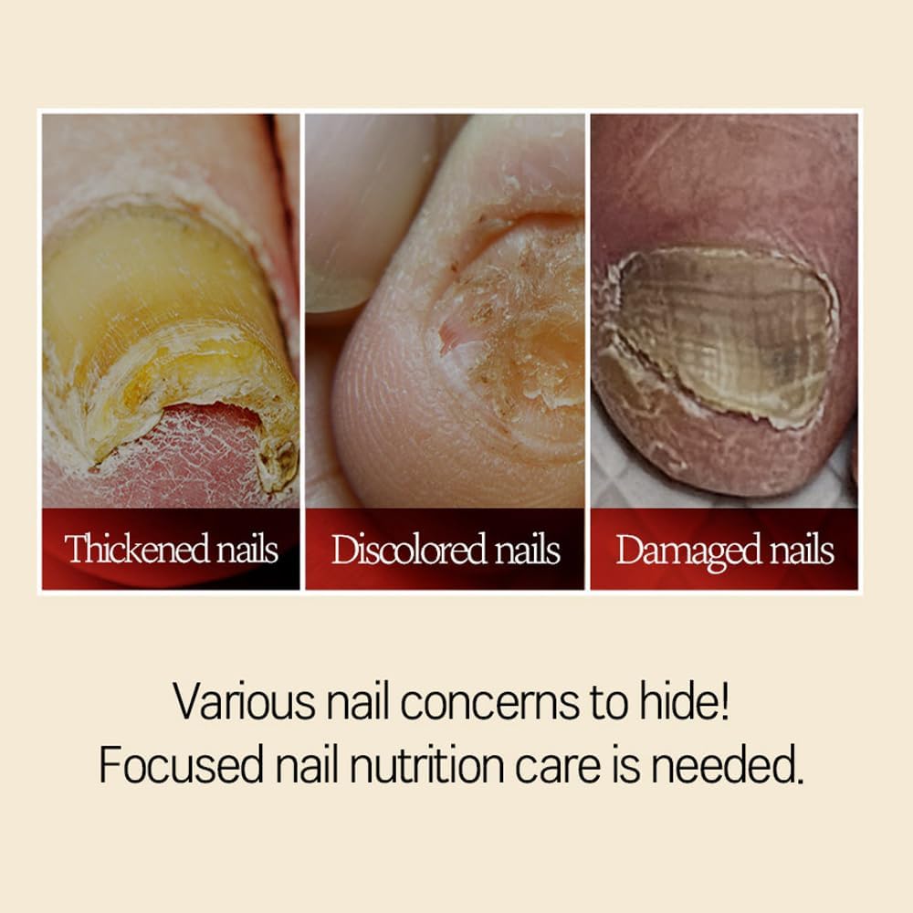 Safepick Intensive Nail Strengthener Serum for Weak, Thin & Damaged Fingernails - Keratin & Biotin Formula for Restoration & Growth Support - Quick-Drying