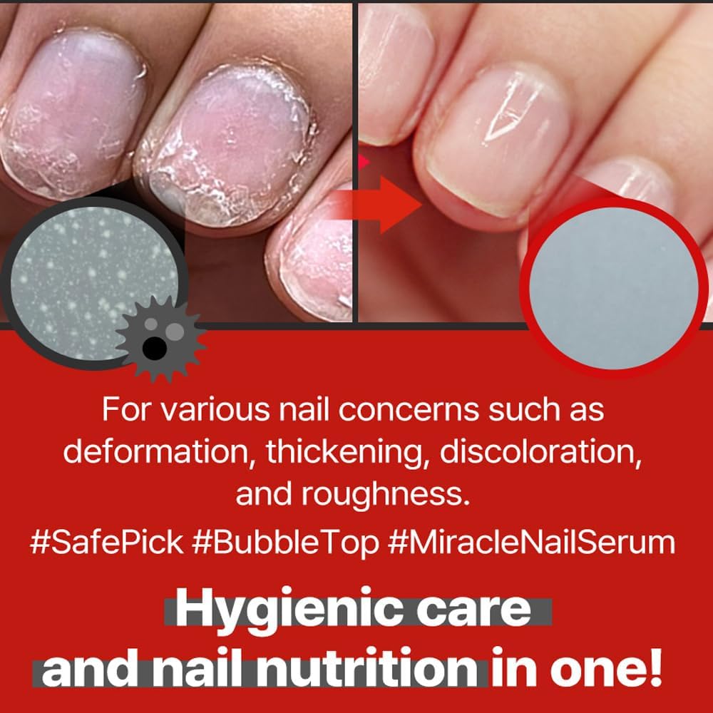 Safepick Intensive Nail Strengthener Serum for Weak, Thin & Damaged Fingernails - Keratin & Biotin Formula for Restoration & Growth Support - Quick-Drying